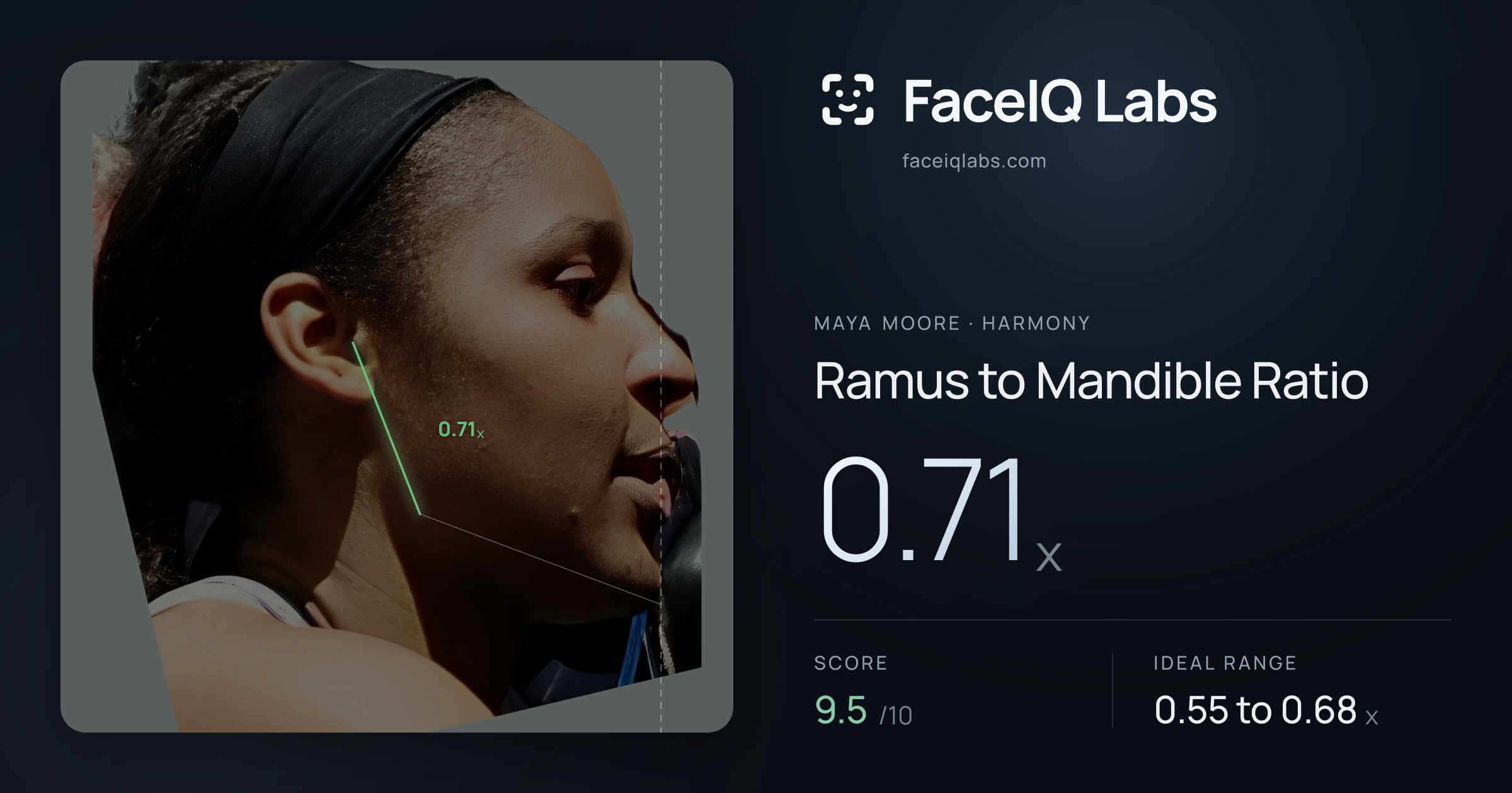 Maya Moore Ramus to Mandible Ratio: 0.71x, drawn on the photo