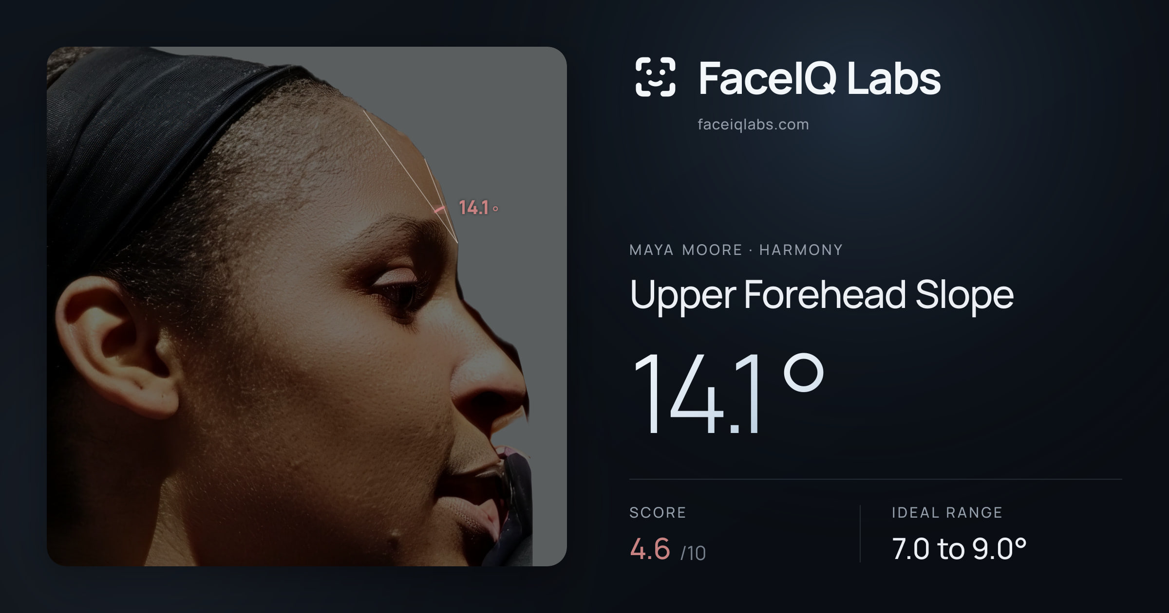 Maya Moore Upper Forehead Slope: 14.1°, drawn on the photo