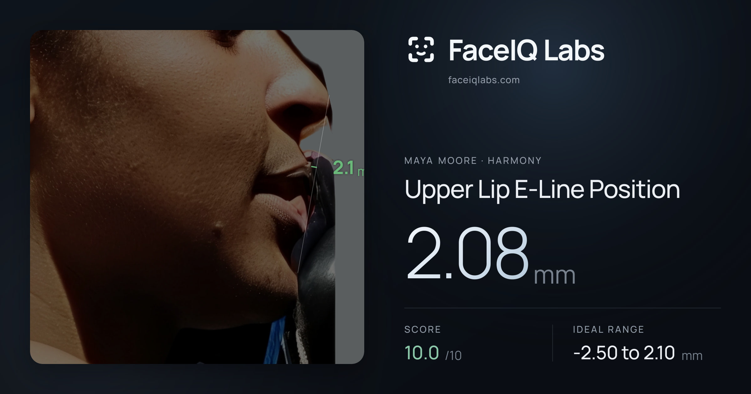 Maya Moore Upper Lip E-Line Position: 2.08mm, drawn on the photo