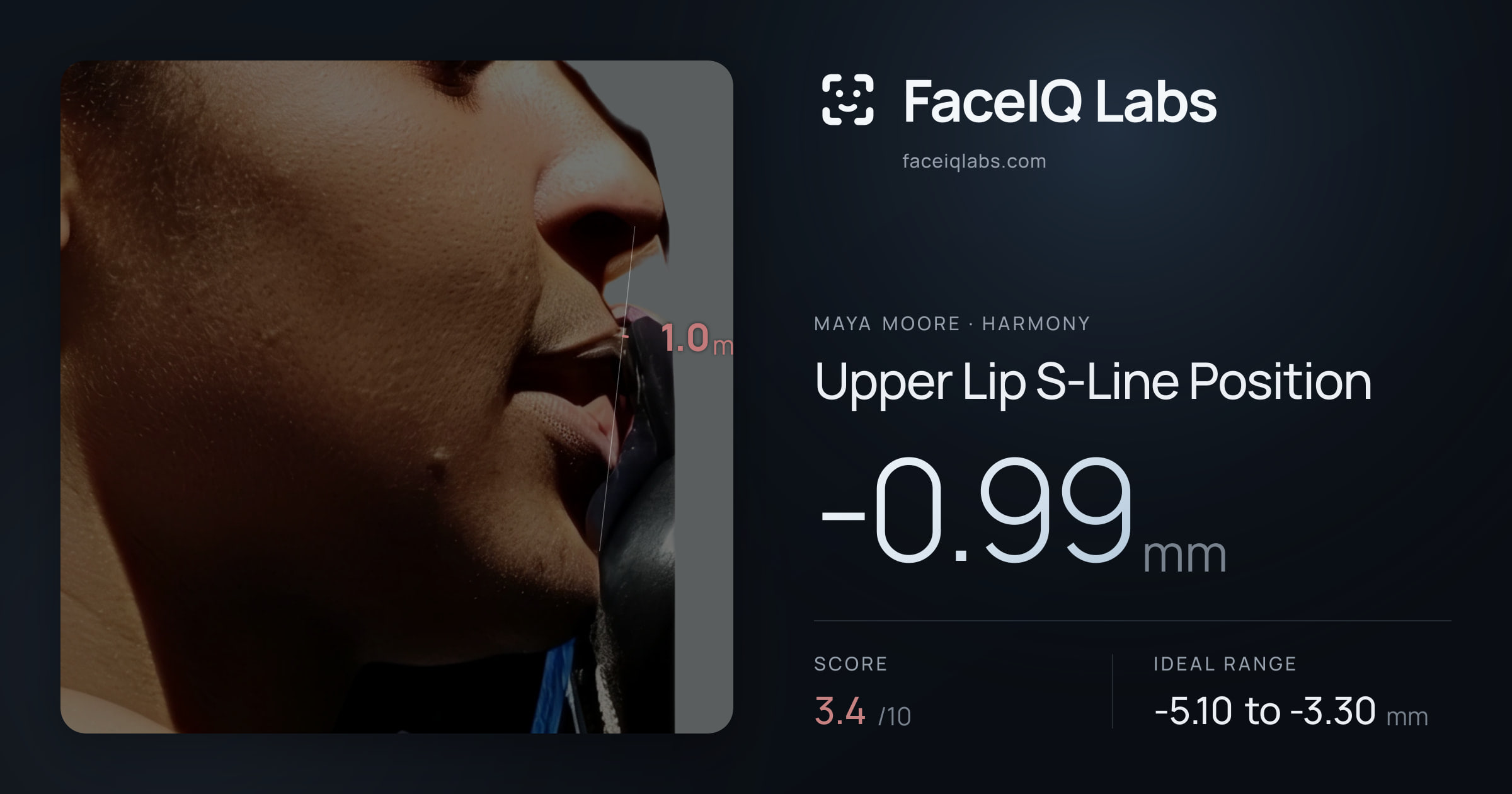 Maya Moore Upper Lip S-Line Position: -0.99mm, drawn on the photo