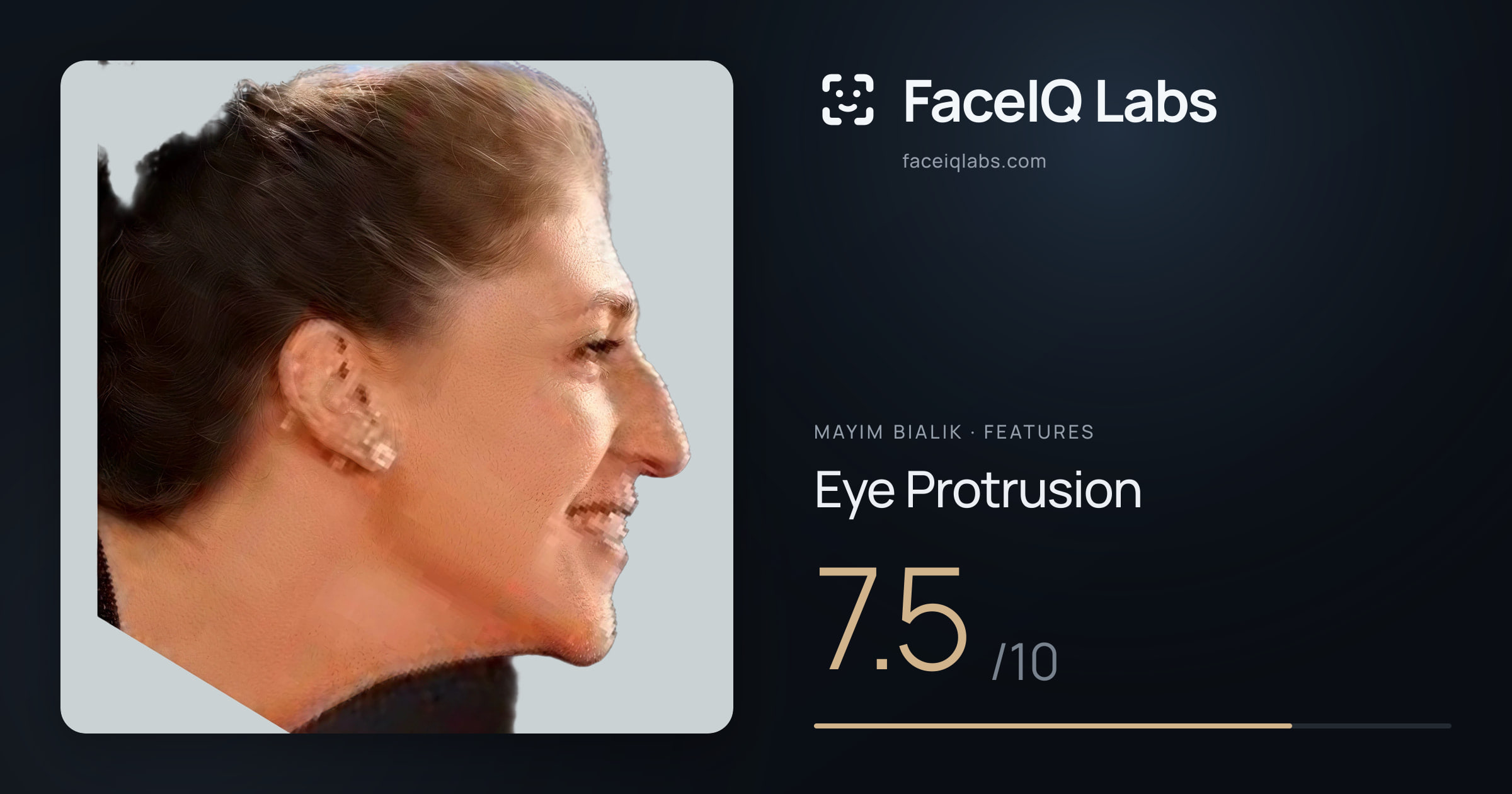 Mayim Bialik Eye Protrusion: 7.5/10, drawn on the photo