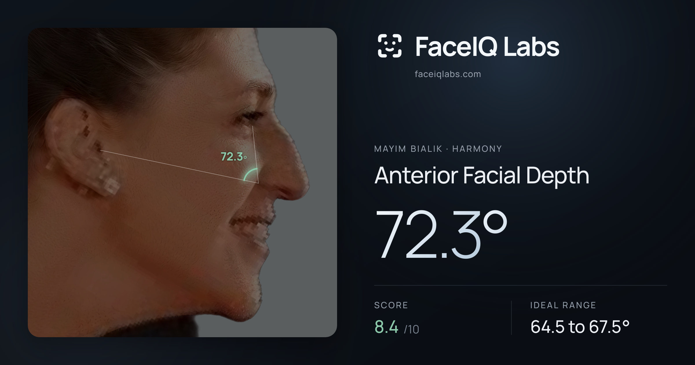 Mayim Bialik Anterior Facial Depth: 72.3°, drawn on the photo