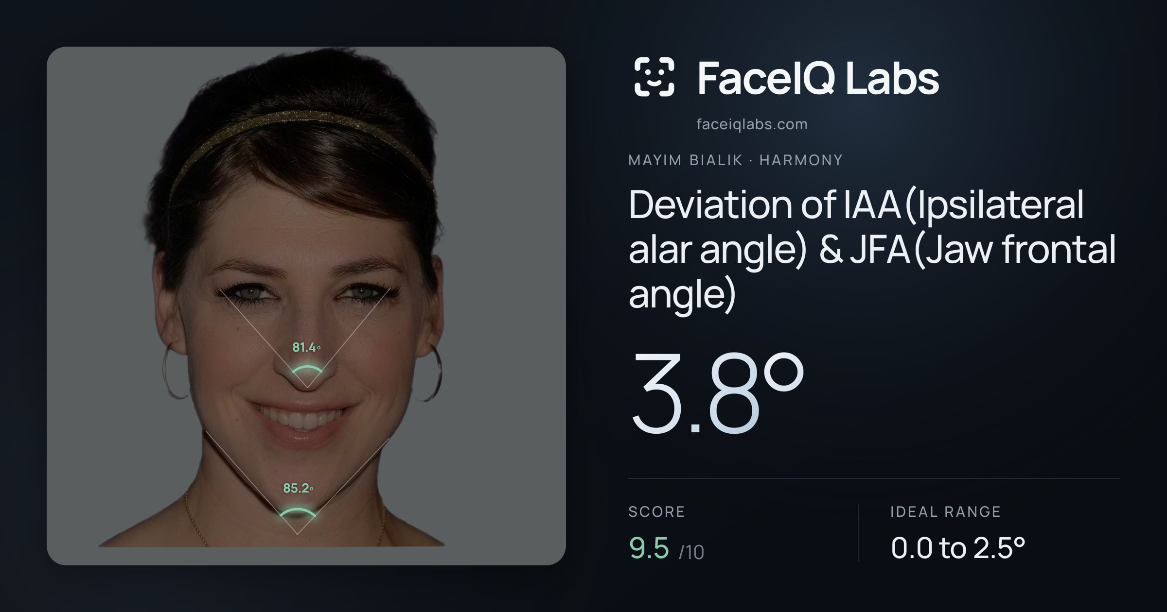 Mayim Bialik Deviation of IAA(Ipsilateral alar angle) & JFA(Jaw frontal angle): 3.8°, drawn on the photo