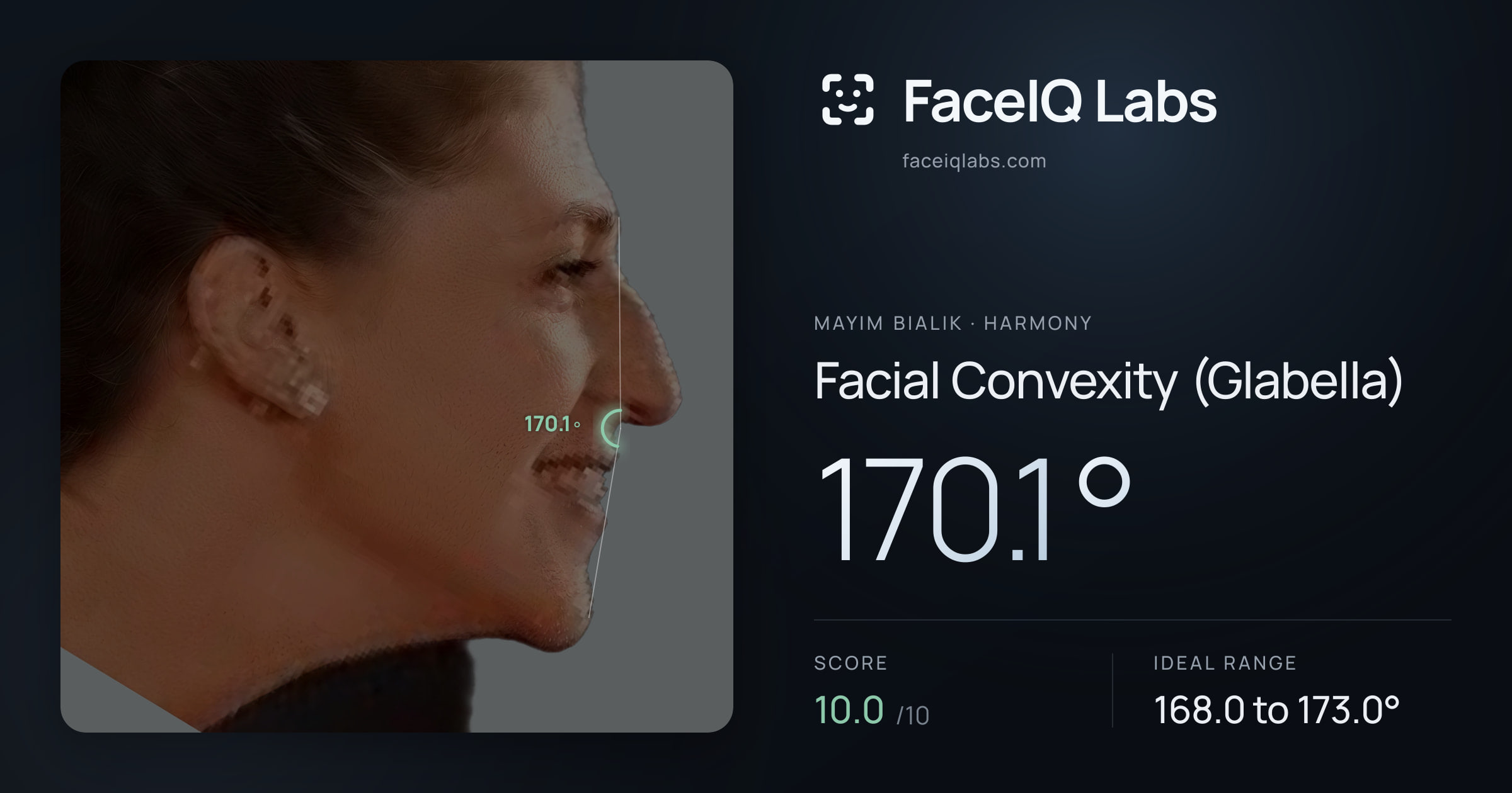 Mayim Bialik Facial Convexity (Glabella): 170.1°, drawn on the photo