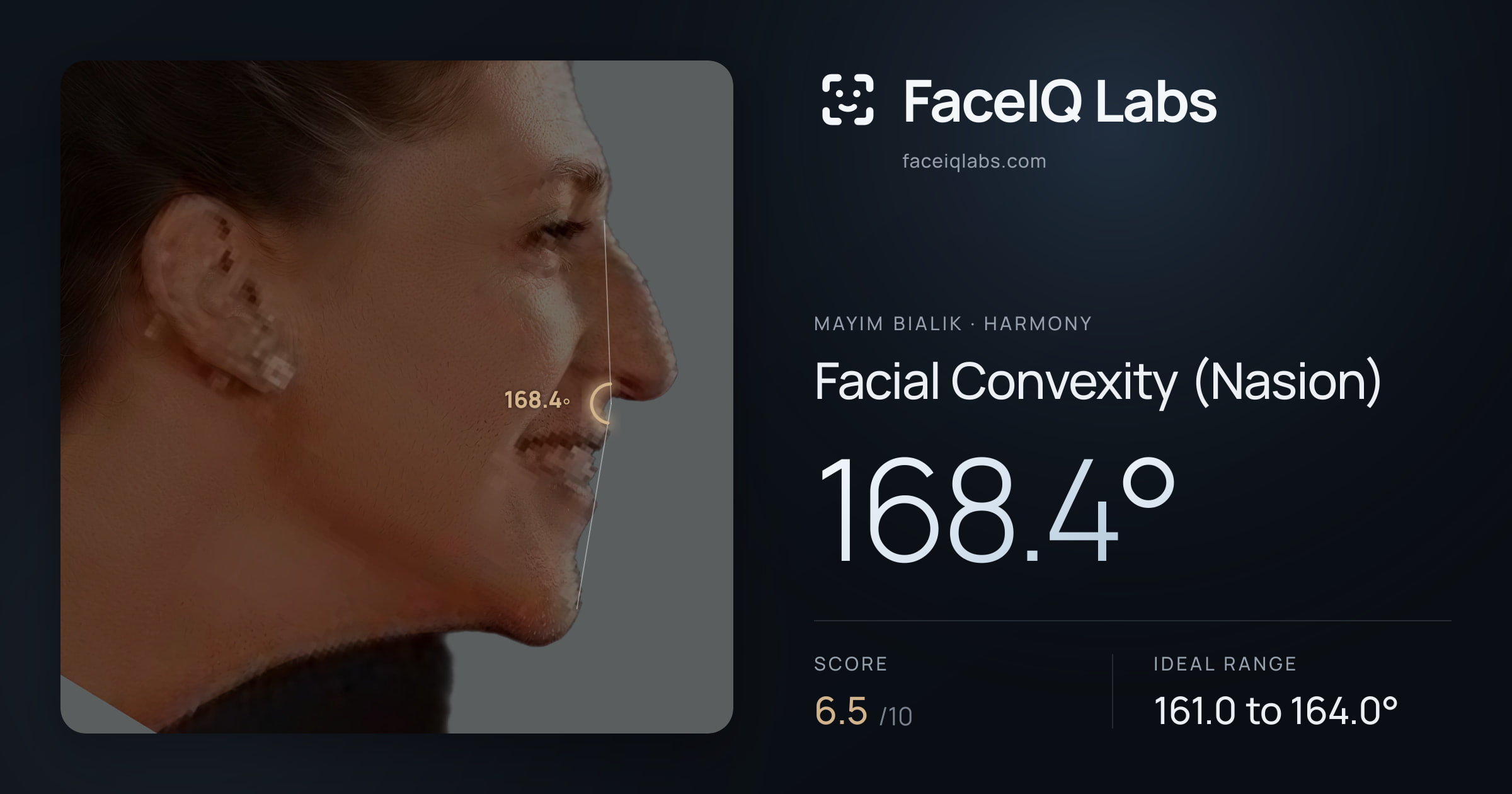 Mayim Bialik Facial Convexity (Nasion): 168.4°, drawn on the photo