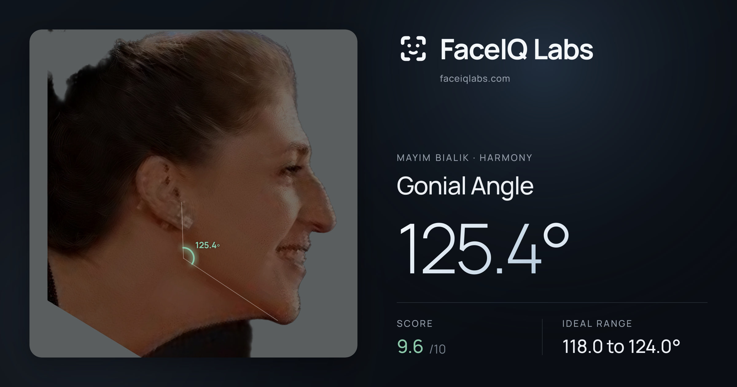 Mayim Bialik Gonial Angle: 125.4°, drawn on the photo