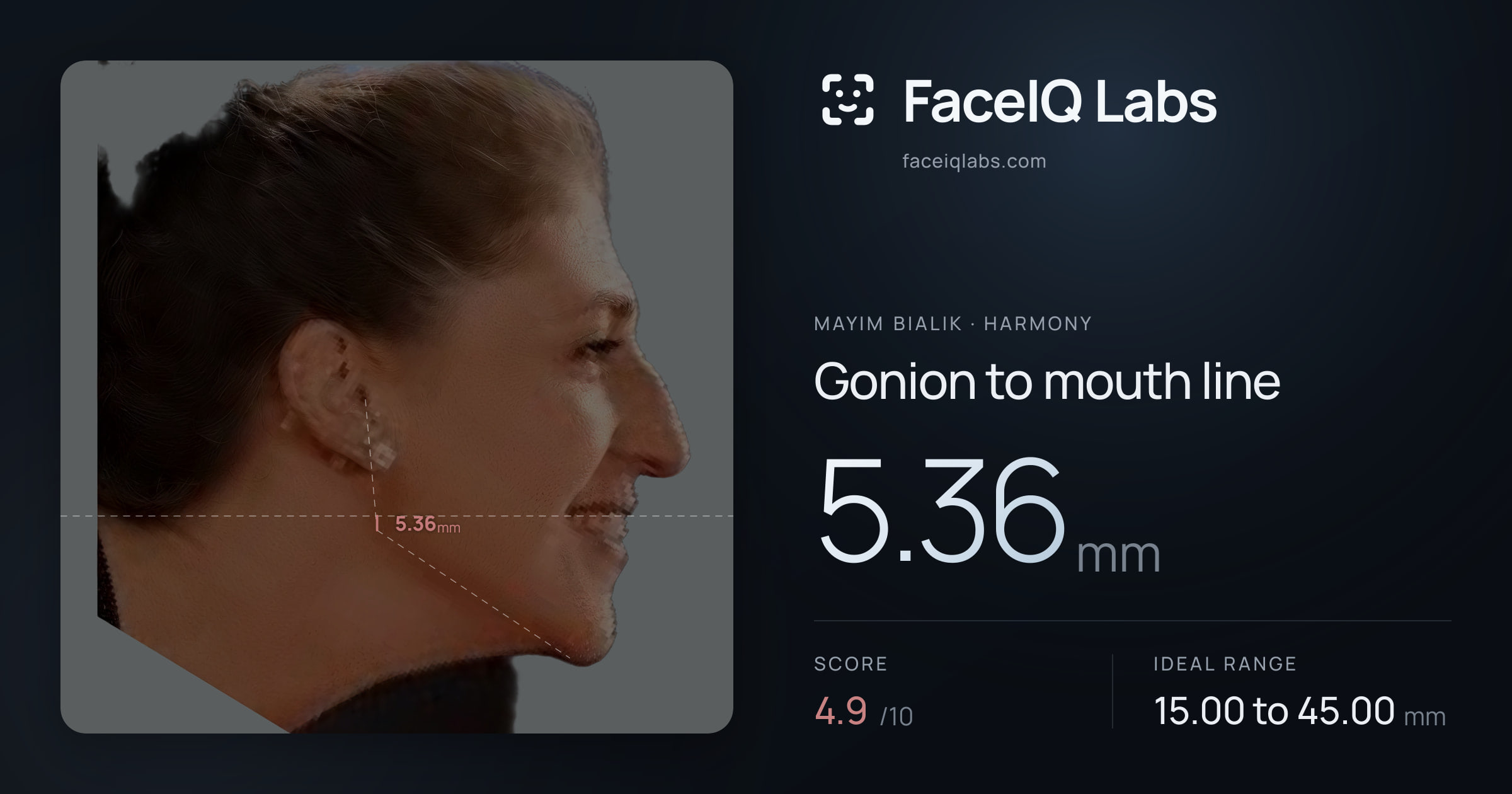 Mayim Bialik Gonion to mouth line: 5.36mm, drawn on the photo