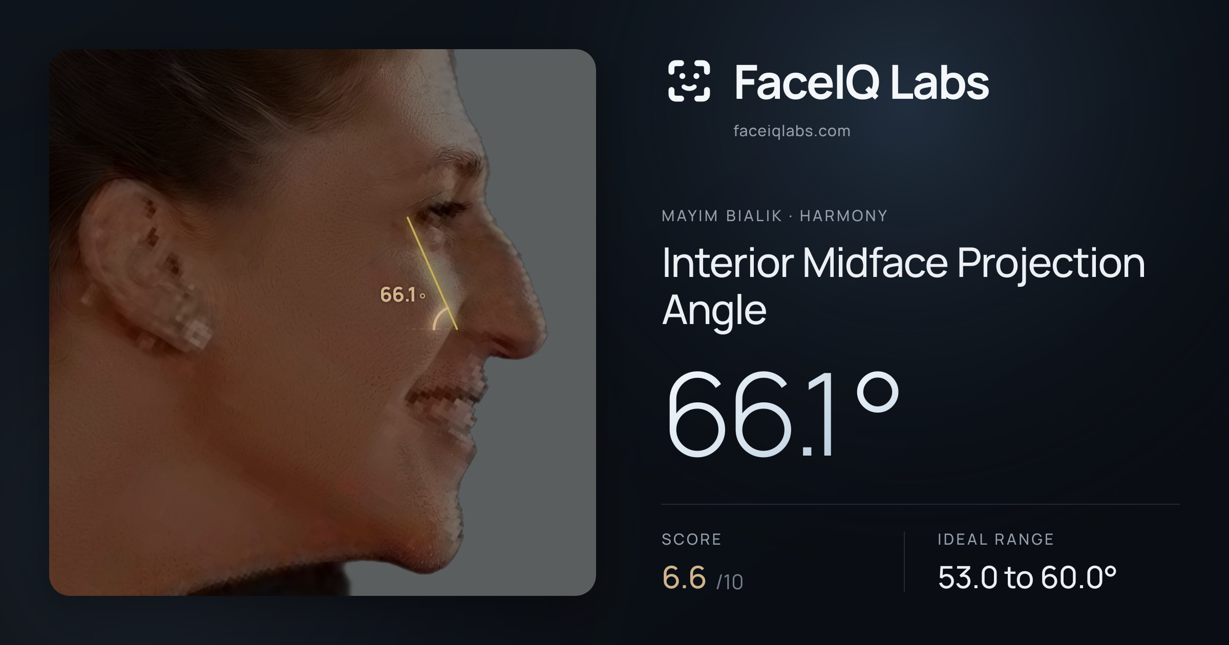 Mayim Bialik Interior Midface Projection Angle: 66.1°, drawn on the photo