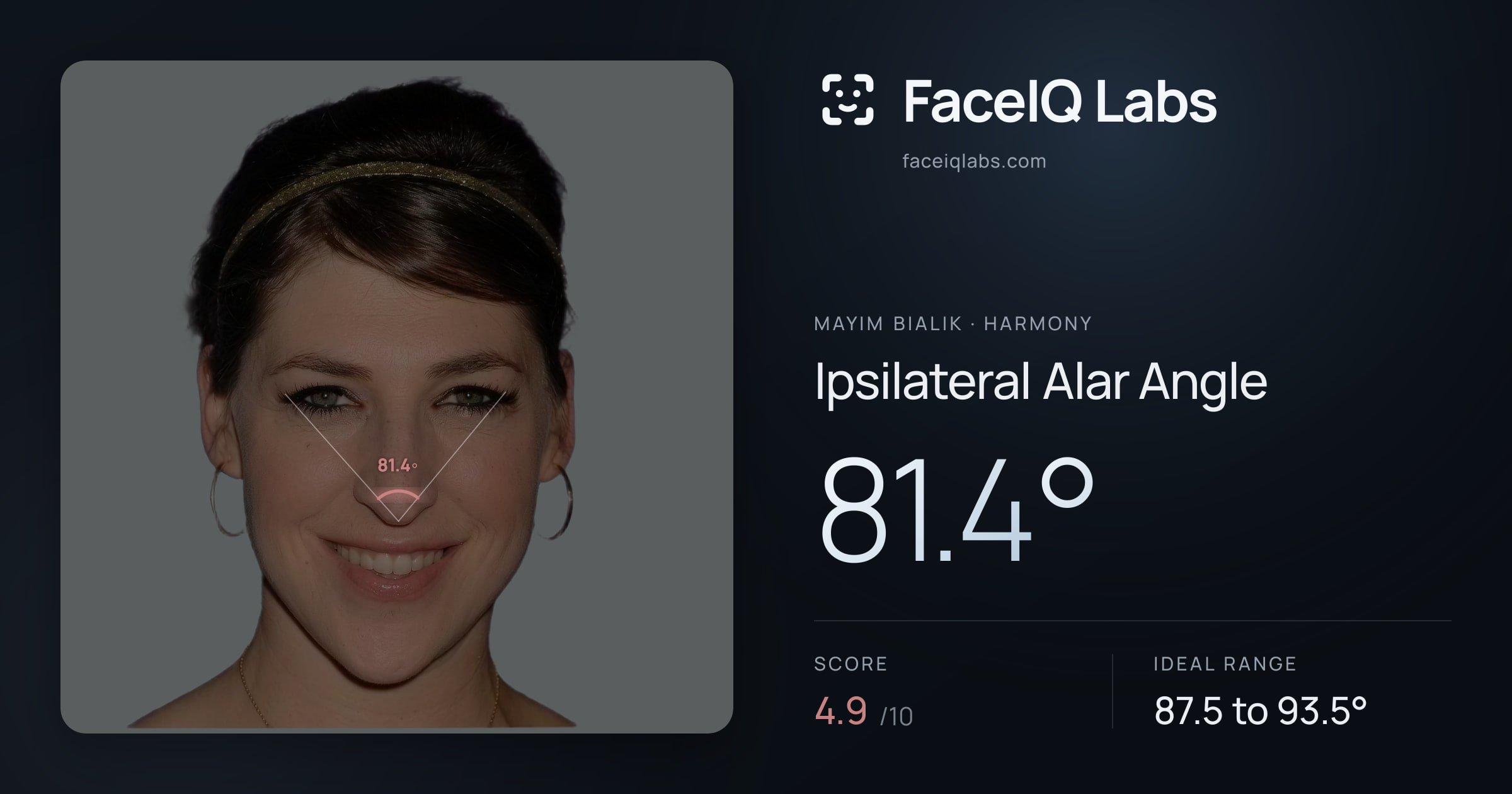 Mayim Bialik Ipsilateral Alar Angle: 81.4°, drawn on the photo