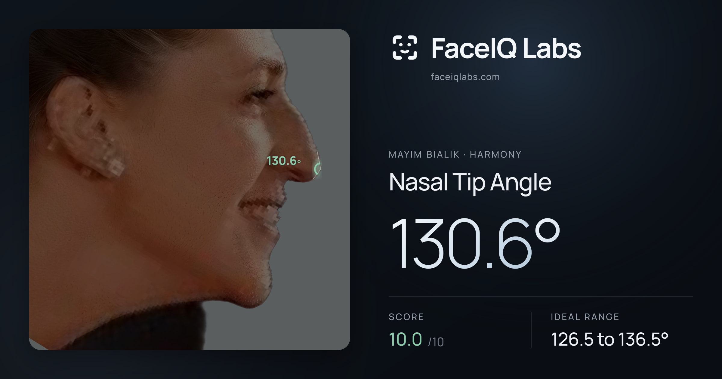 Mayim Bialik Nasal Tip Angle: 130.6°, drawn on the photo