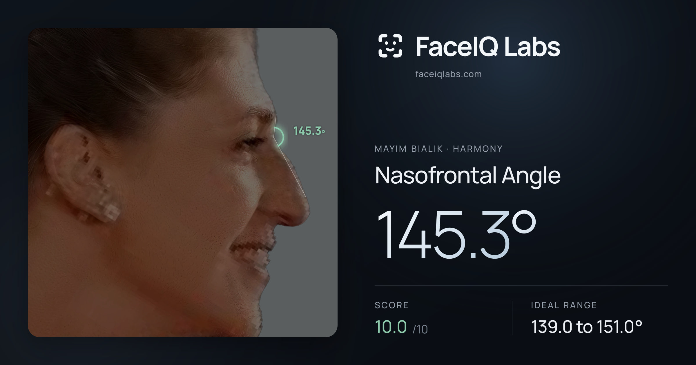 Mayim Bialik Nasofrontal Angle: 145.3°, drawn on the photo