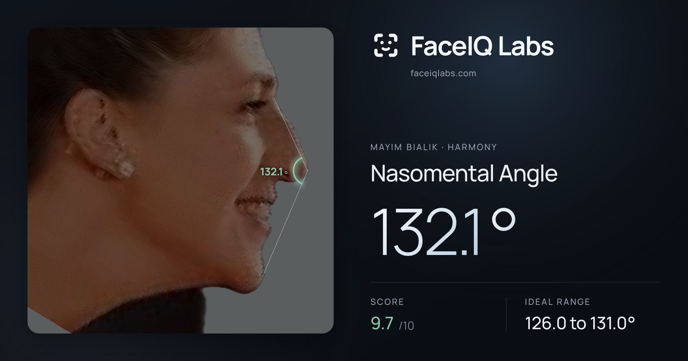 Mayim Bialik Nasomental Angle: 132.1°, drawn on the photo