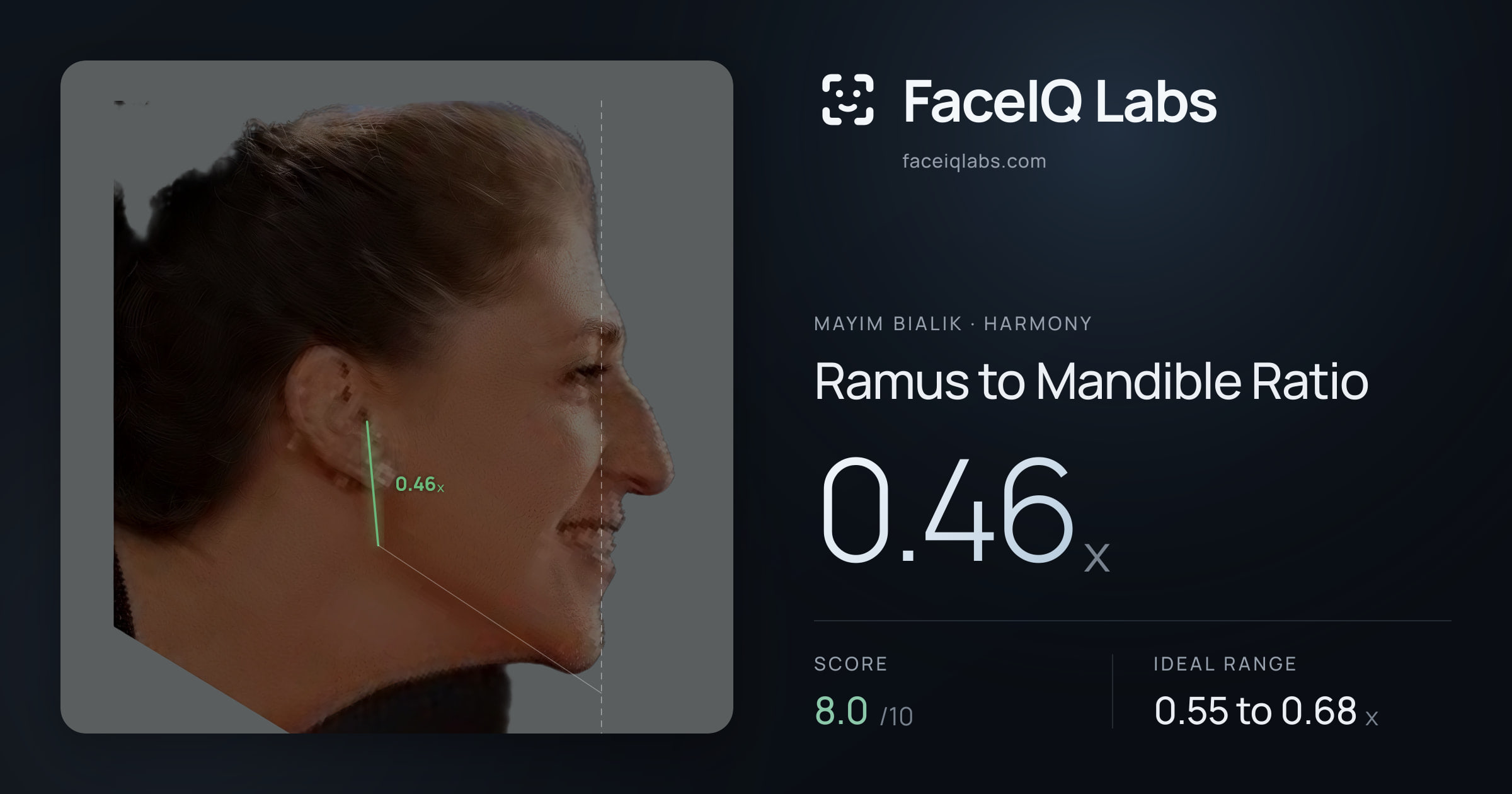 Mayim Bialik Ramus to Mandible Ratio: 0.46x, drawn on the photo