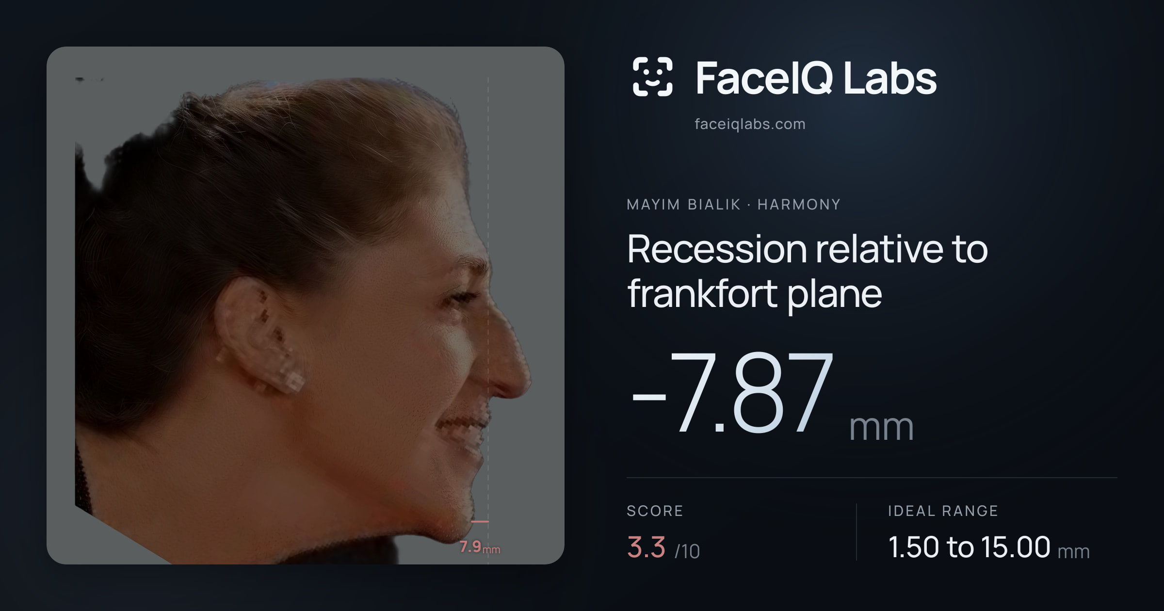 Mayim Bialik Recession relative to frankfort plane: -7.87mm, drawn on the photo