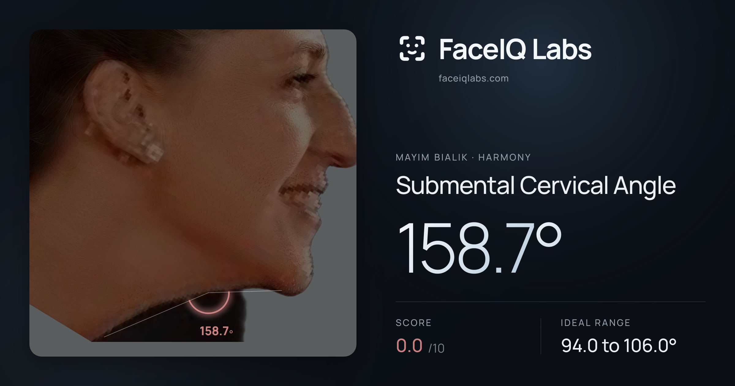 Mayim Bialik Submental Cervical Angle: 158.7°, drawn on the photo