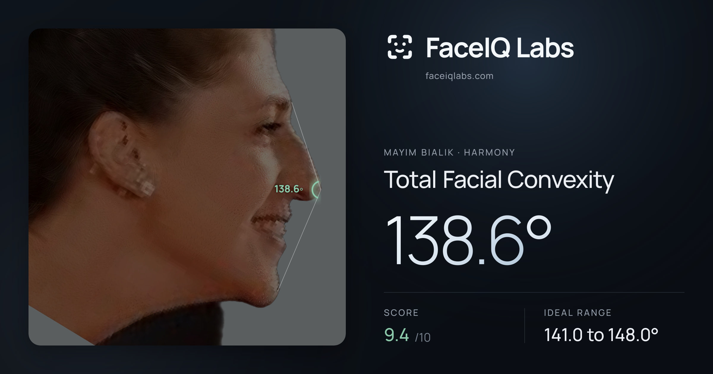 Mayim Bialik Total Facial Convexity: 138.6°, drawn on the photo