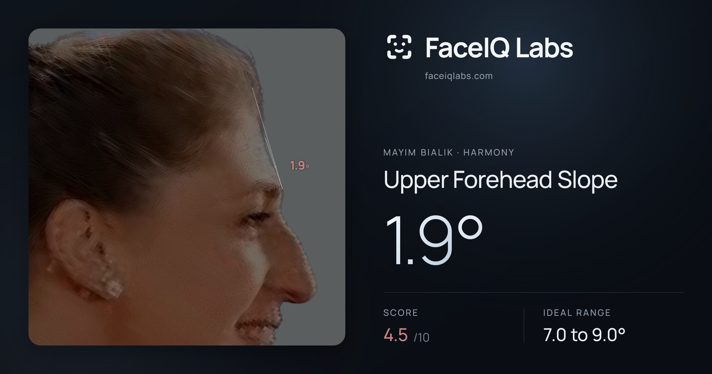 Mayim Bialik Upper Forehead Slope: 1.9°, drawn on the photo