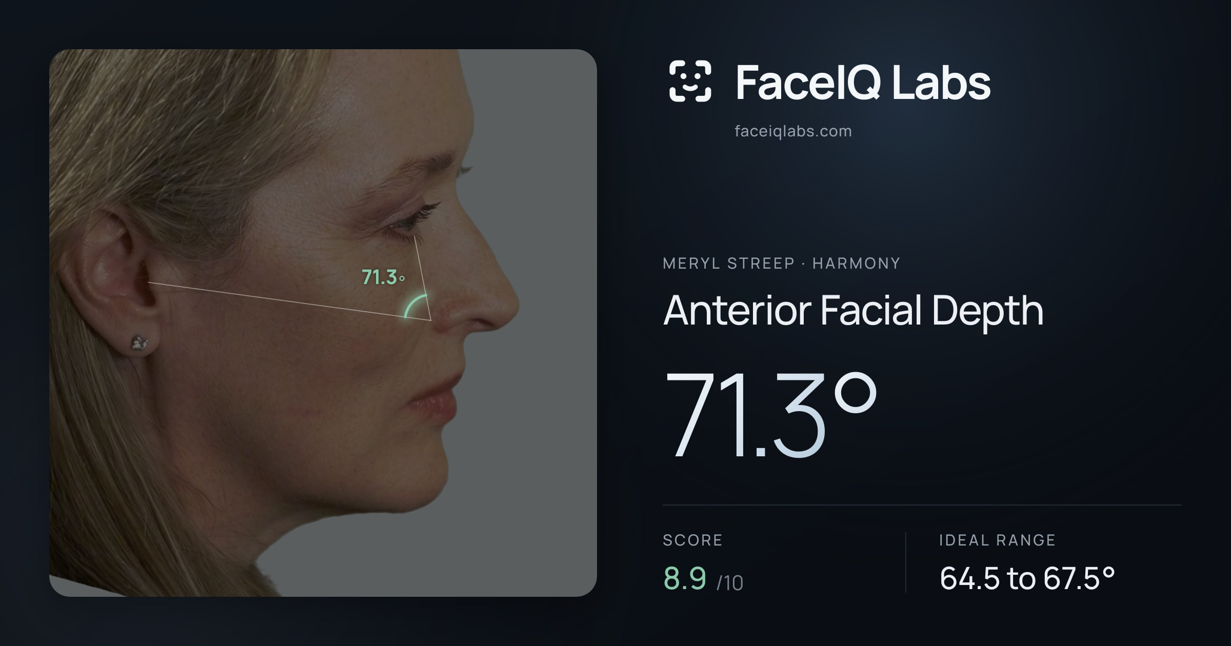 Meryl Streep Anterior Facial Depth: 71.3°, drawn on the photo