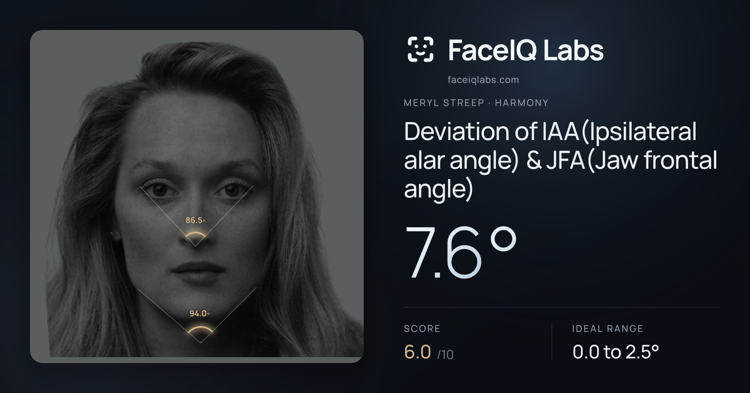 Meryl Streep Deviation of IAA(Ipsilateral alar angle) & JFA(Jaw frontal angle): 7.6°, drawn on the photo