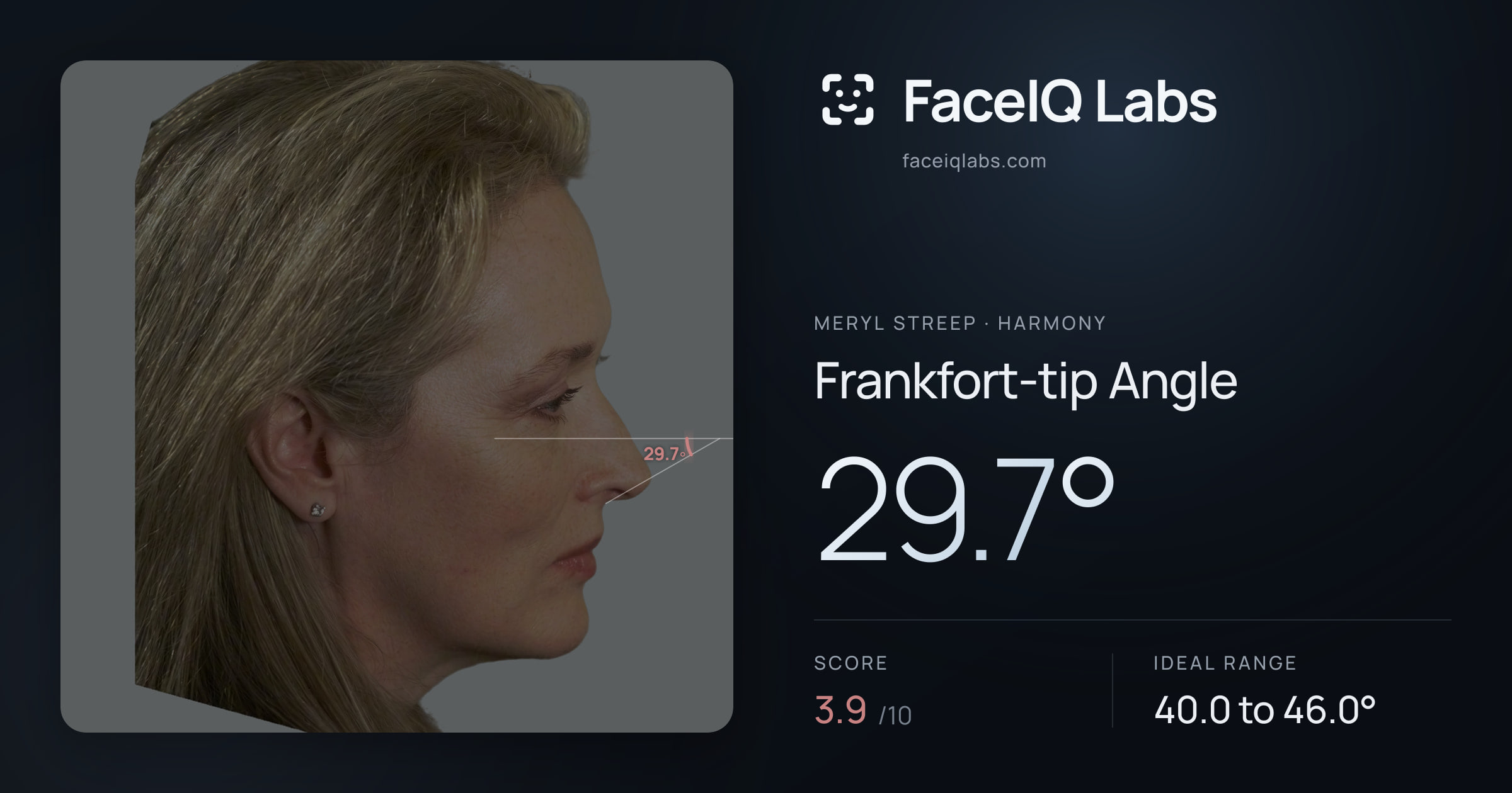 Meryl Streep Frankfort-tip Angle: 29.7°, drawn on the photo