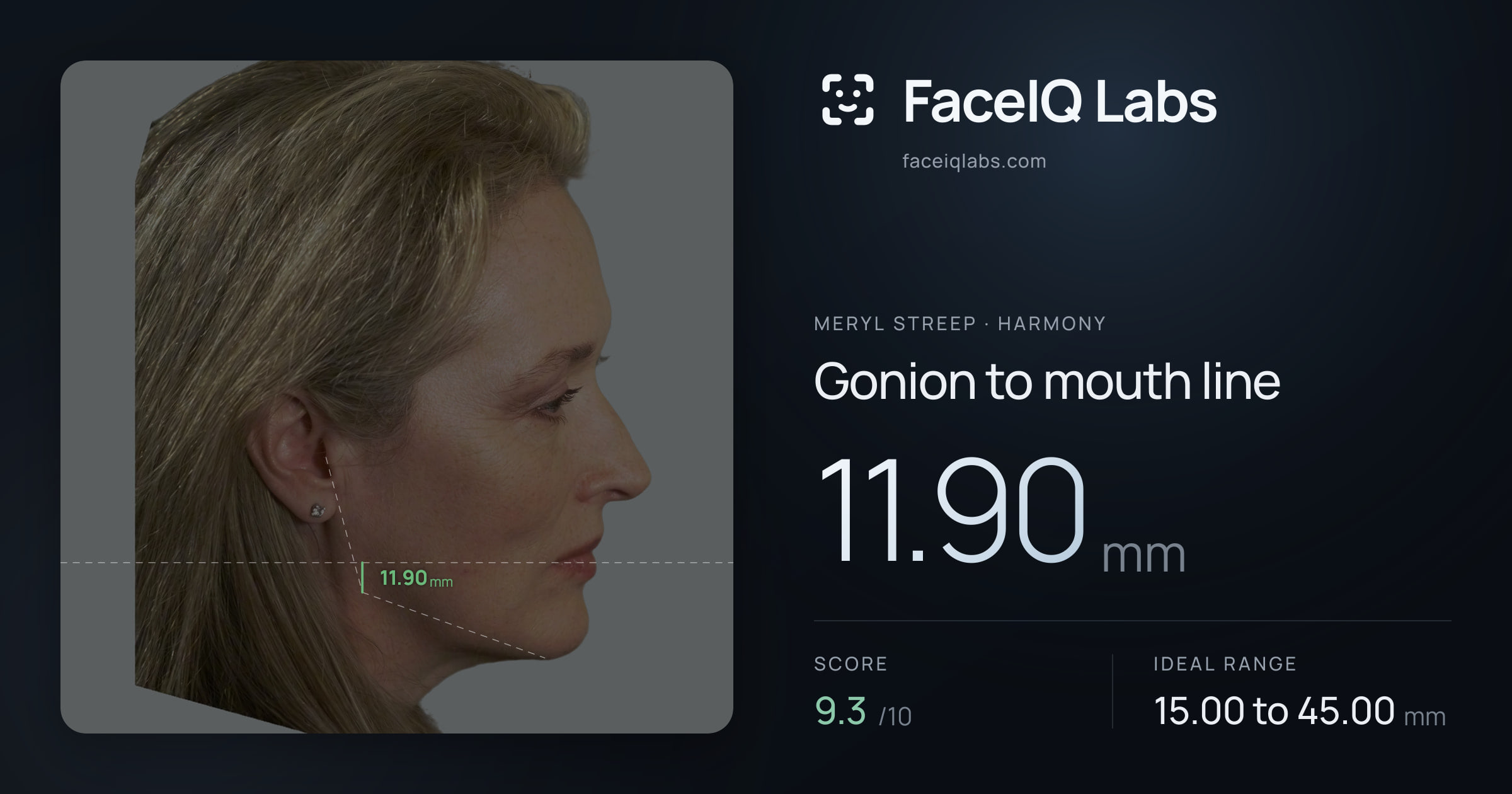 Meryl Streep Gonion to mouth line: 11.90mm, drawn on the photo