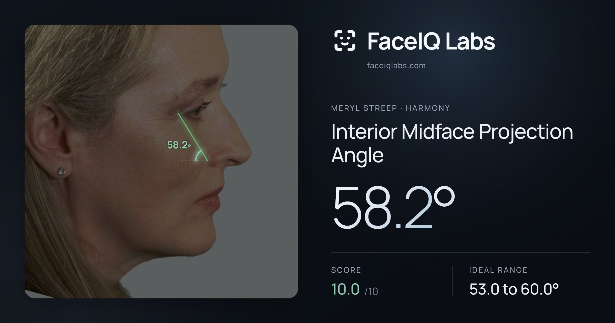 Meryl Streep Interior Midface Projection Angle: 58.2°, drawn on the photo