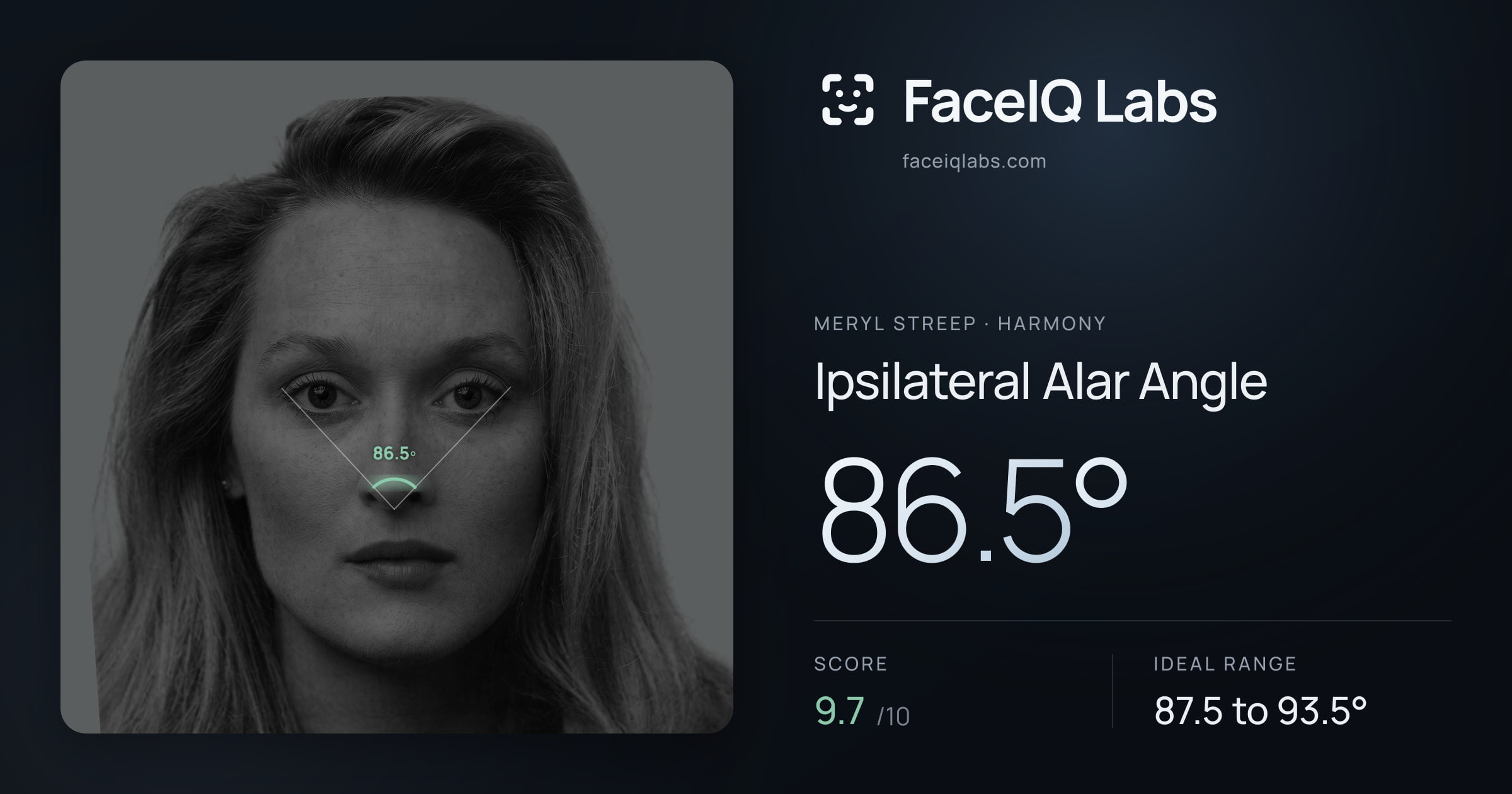 Meryl Streep Ipsilateral Alar Angle: 86.5°, drawn on the photo