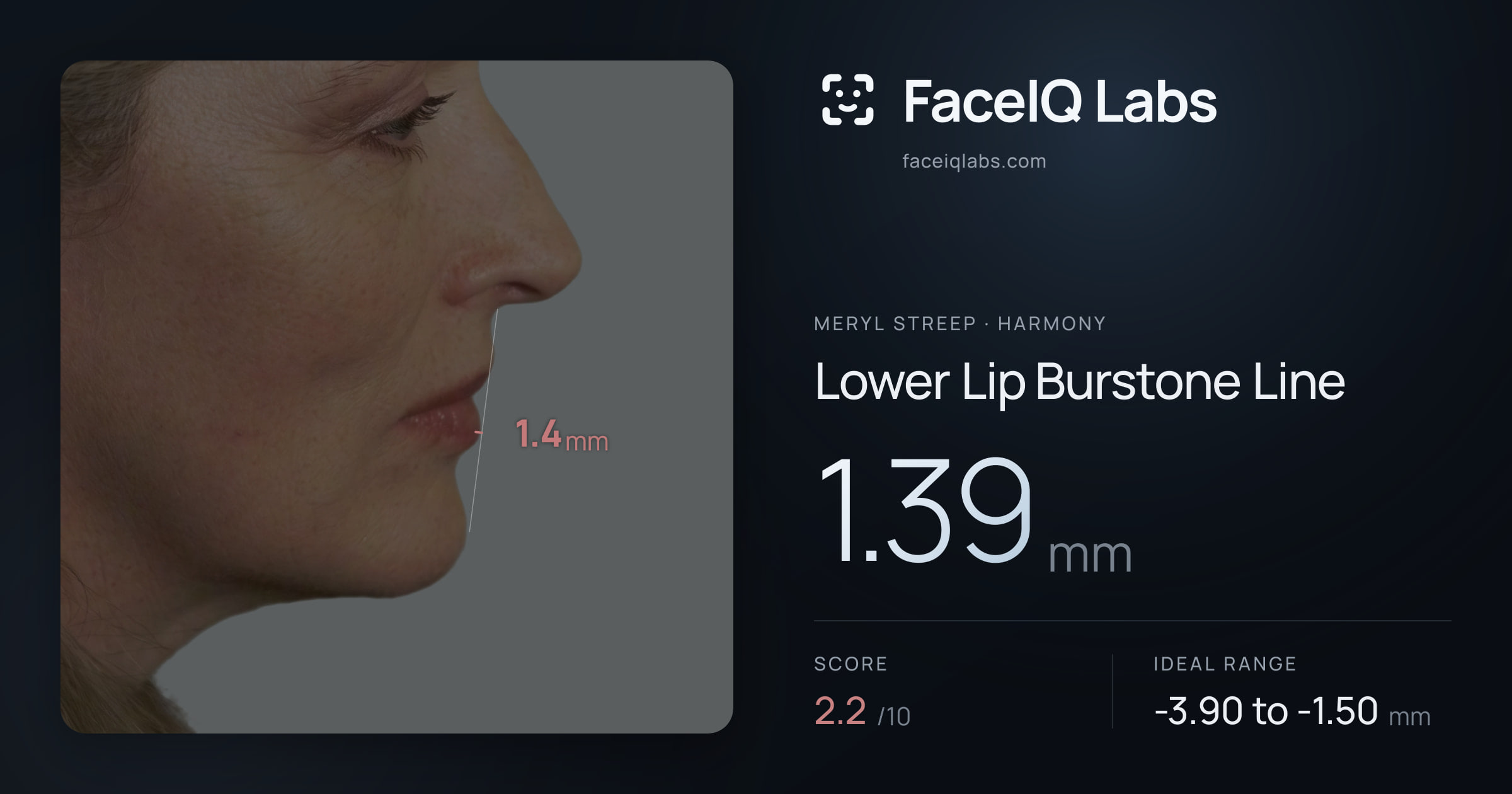 Meryl Streep Lower Lip Burstone Line: 1.39mm, drawn on the photo