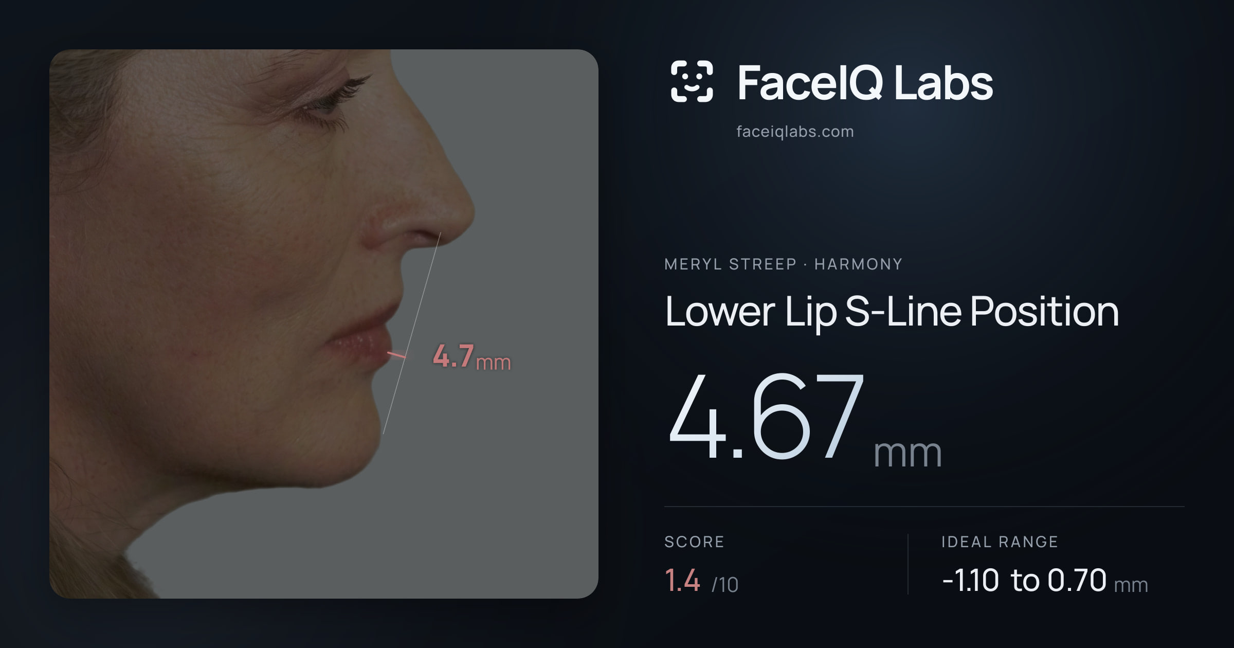 Meryl Streep Lower Lip S-Line Position: 4.67mm, drawn on the photo
