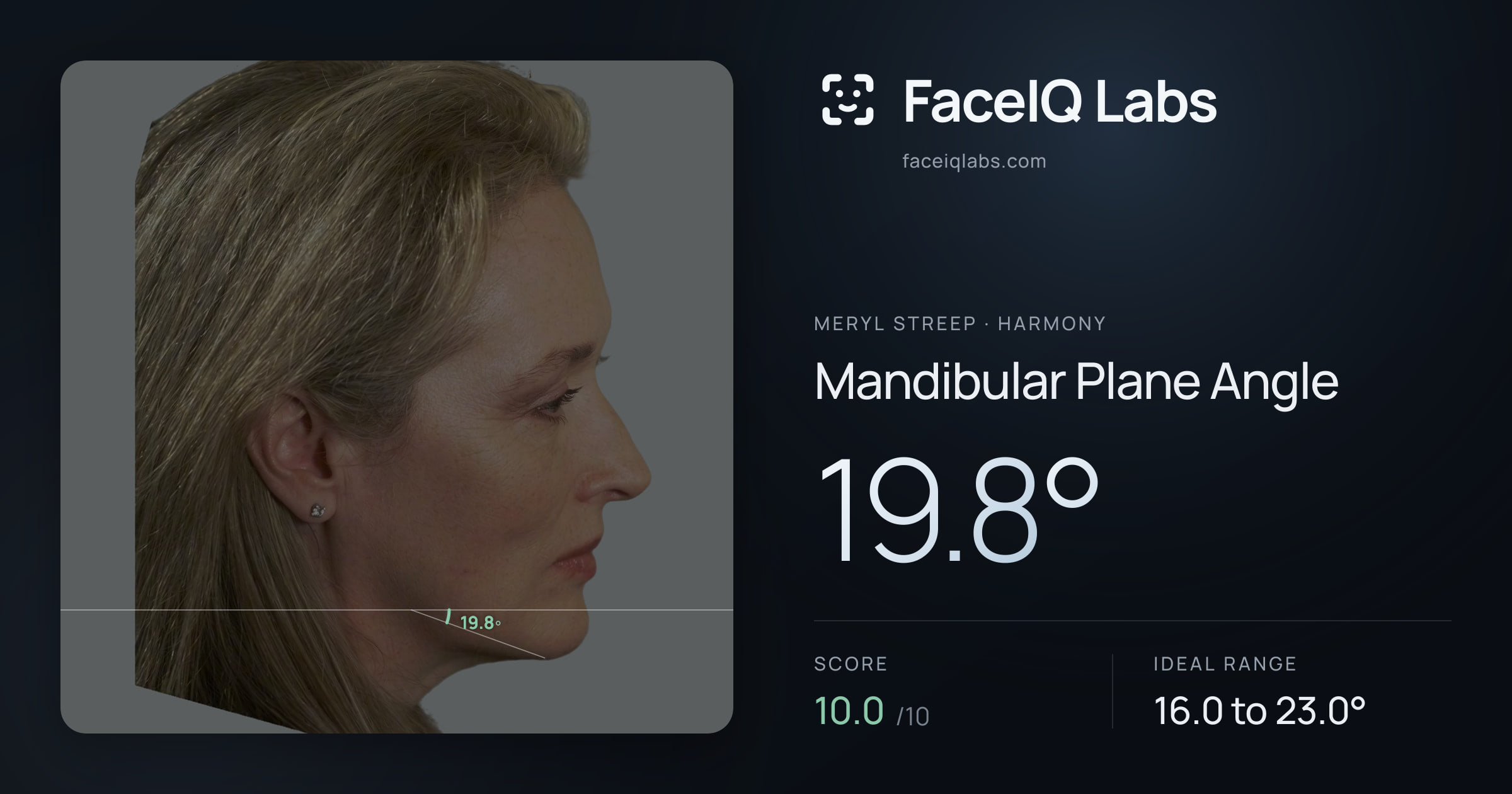 Meryl Streep Mandibular Plane Angle: 19.8°, drawn on the photo