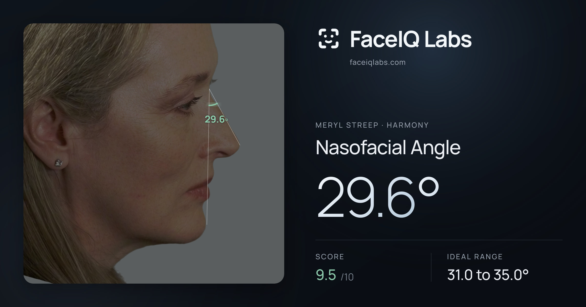 Meryl Streep Nasofacial Angle: 29.6°, drawn on the photo