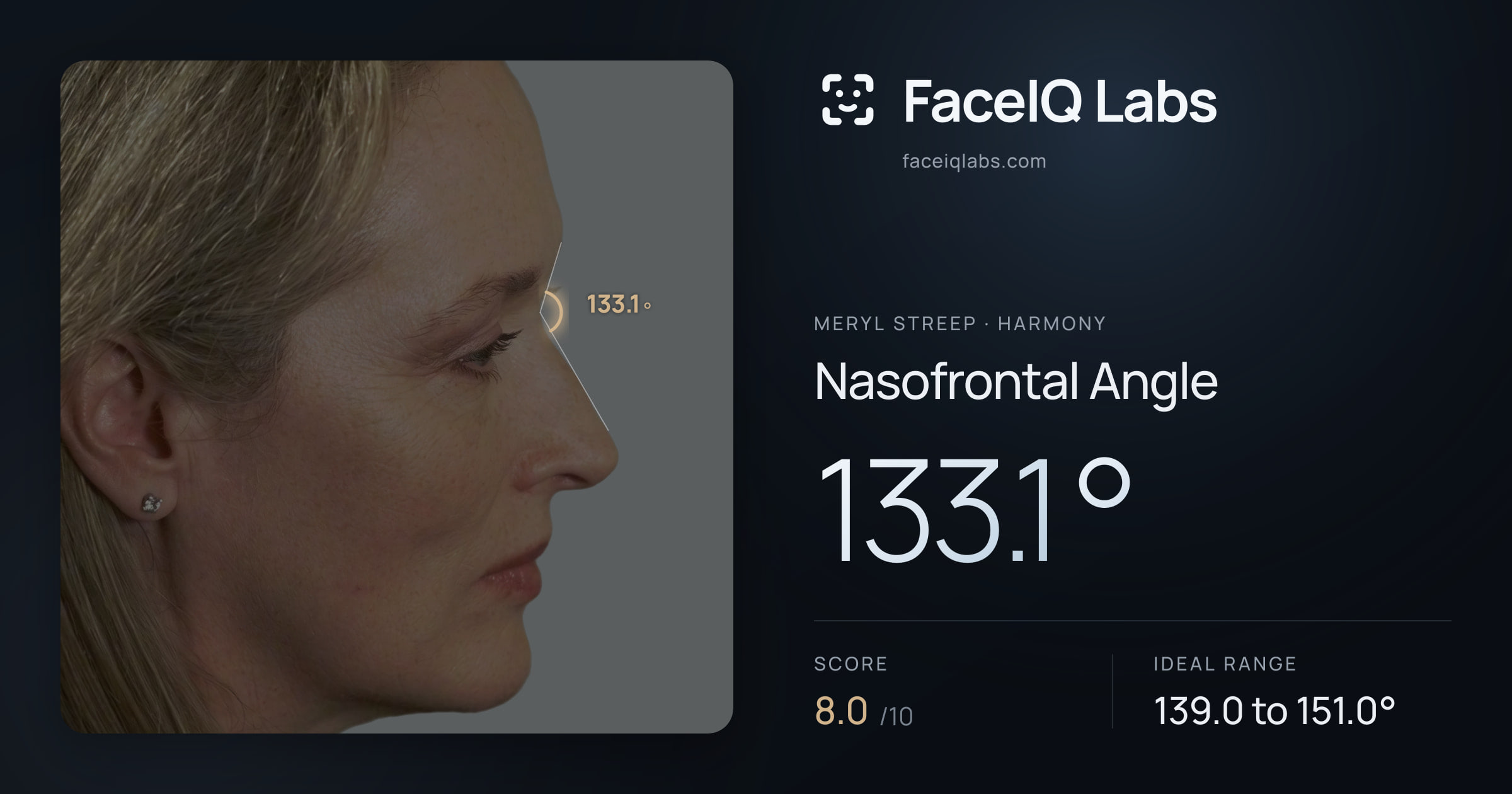 Meryl Streep Nasofrontal Angle: 133.1°, drawn on the photo