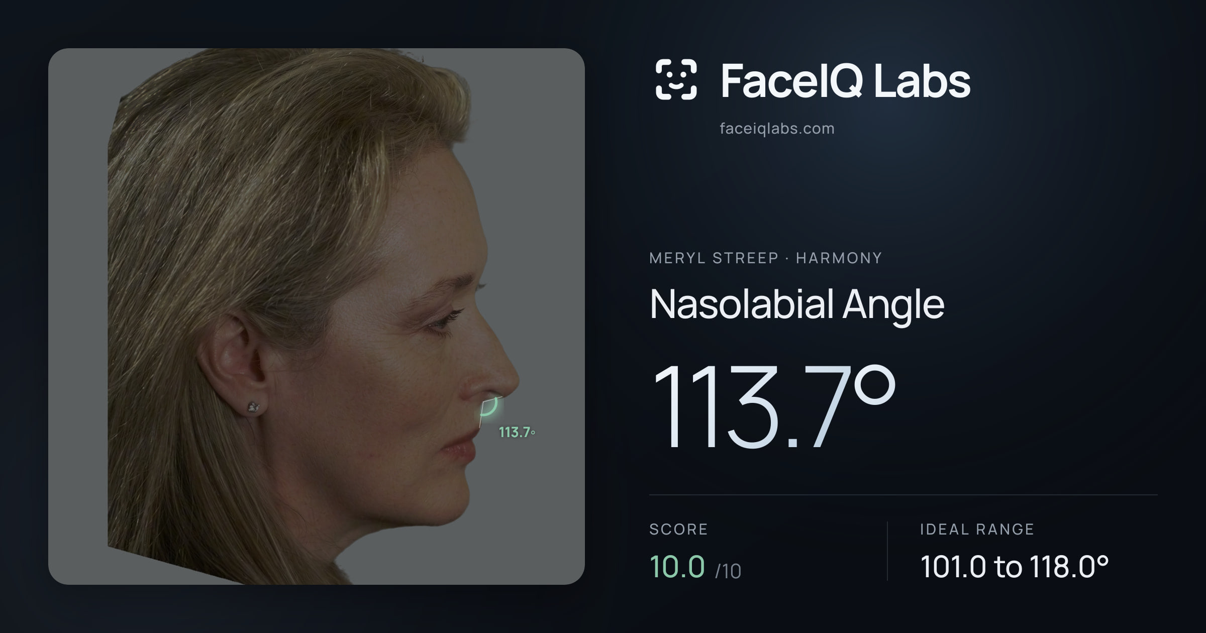 Meryl Streep Nasolabial Angle: 113.7°, drawn on the photo