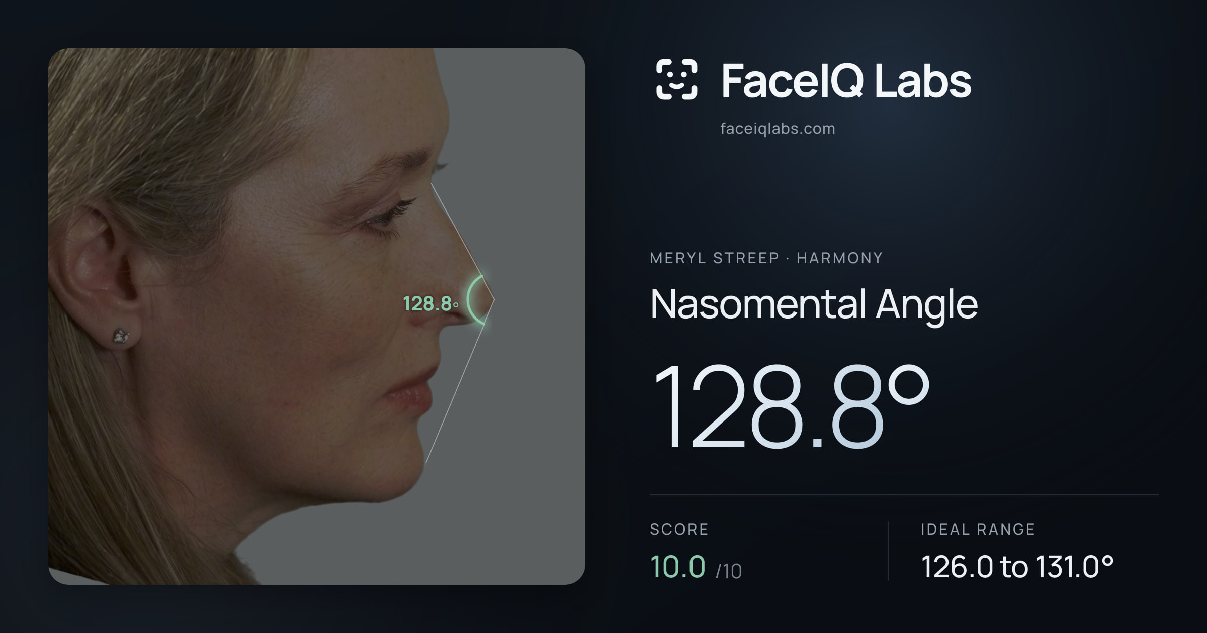 Meryl Streep Nasomental Angle: 128.8°, drawn on the photo