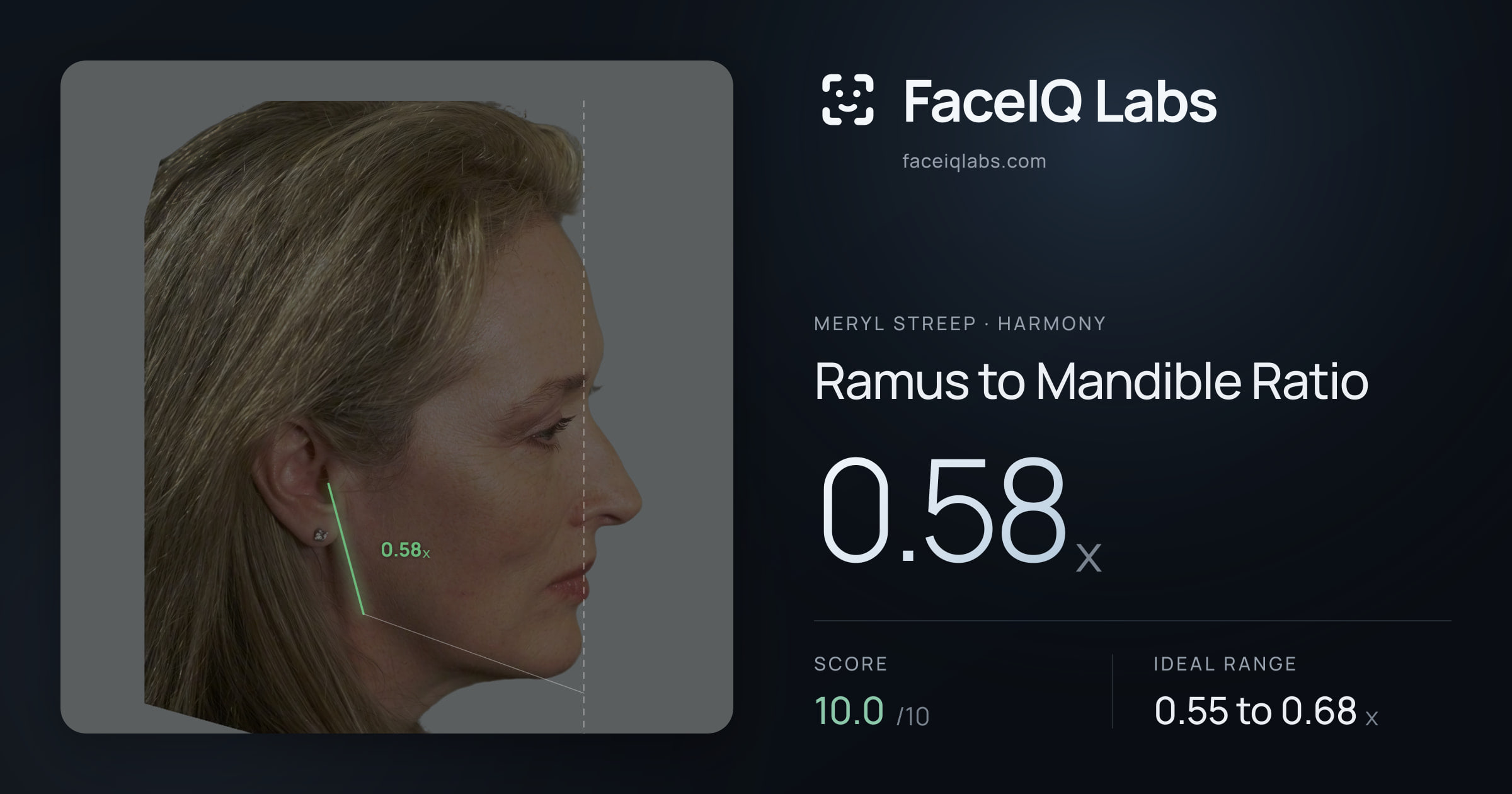 Meryl Streep Ramus to Mandible Ratio: 0.58x, drawn on the photo