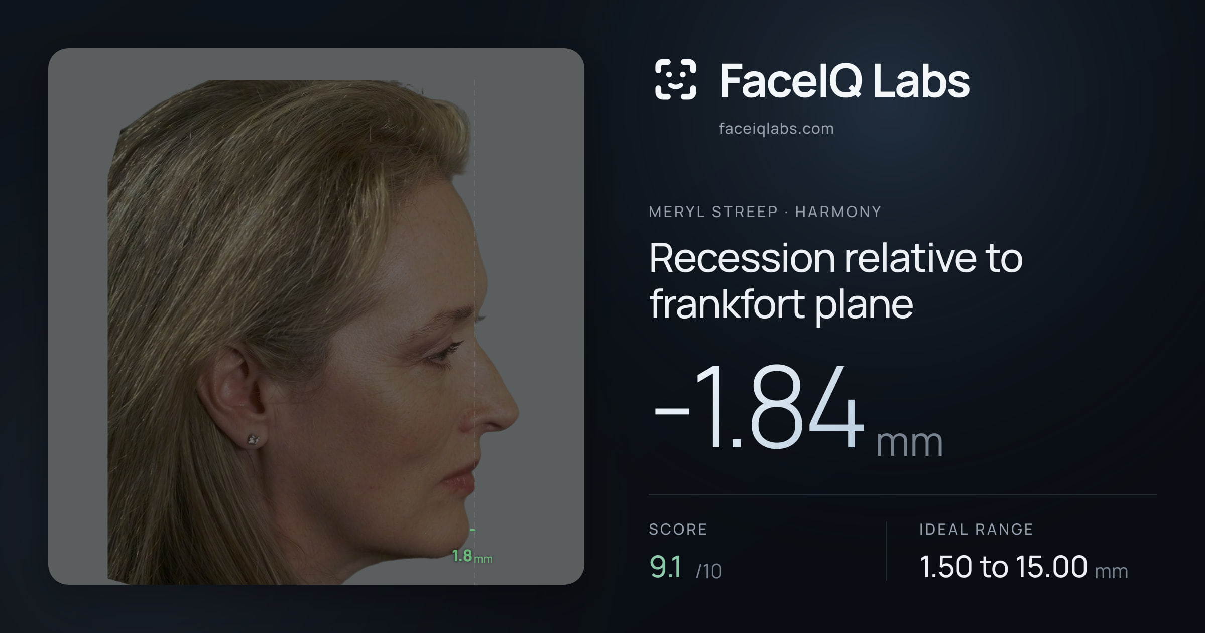 Meryl Streep Recession relative to frankfort plane: -1.84mm, drawn on the photo