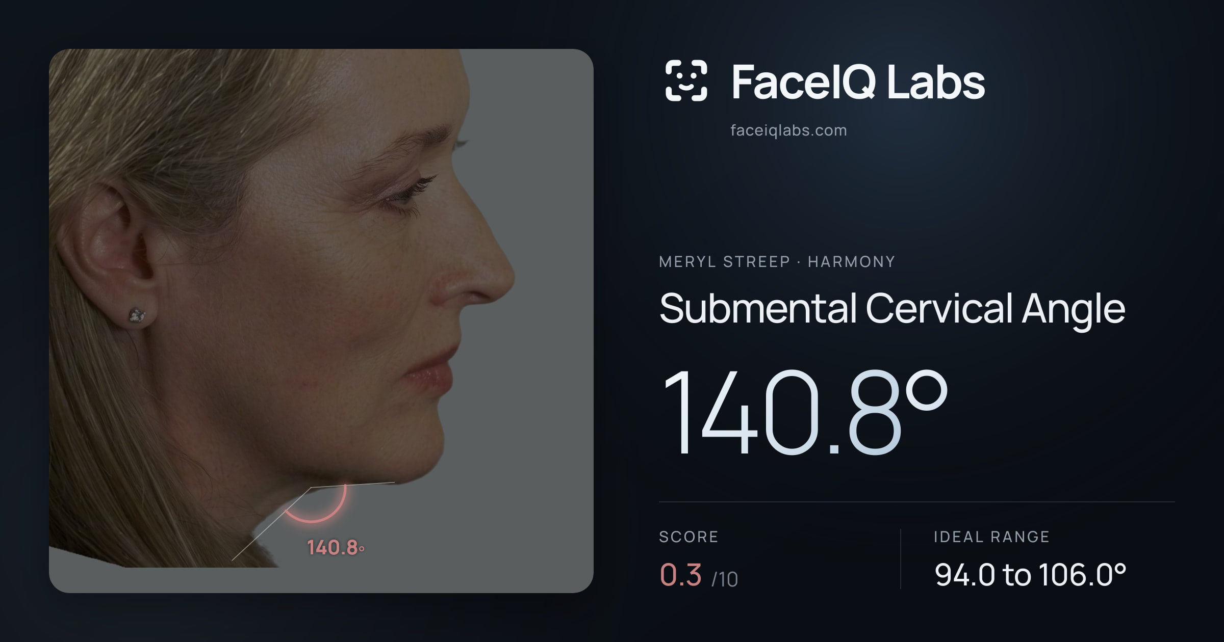Meryl Streep Submental Cervical Angle: 140.8°, drawn on the photo
