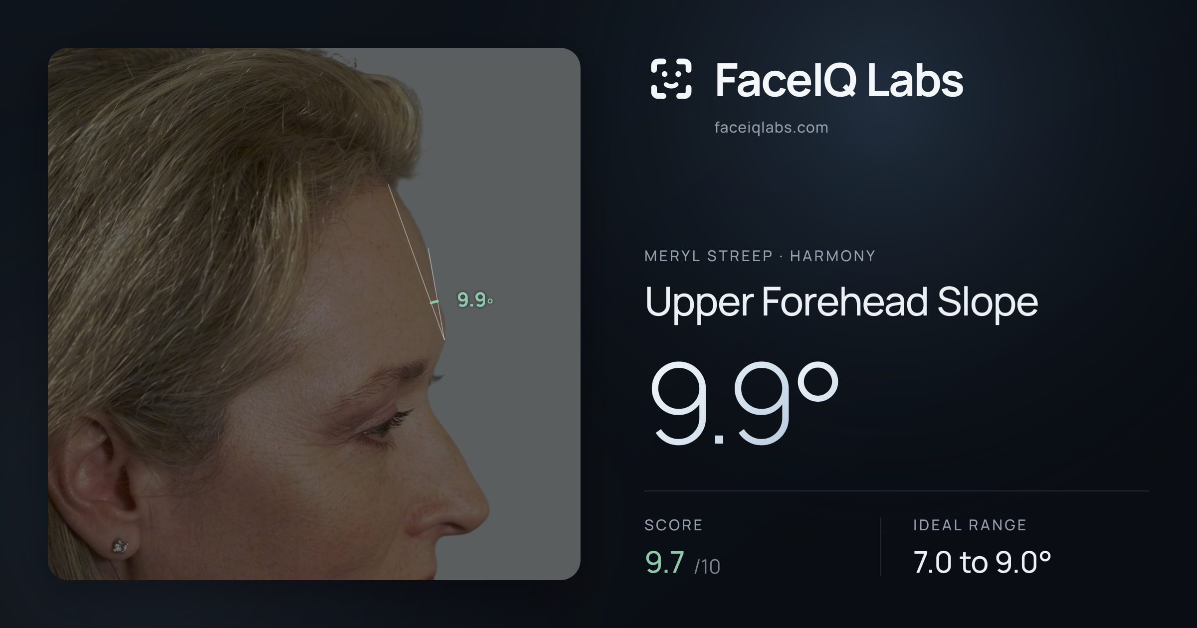 Meryl Streep Upper Forehead Slope: 9.9°, drawn on the photo