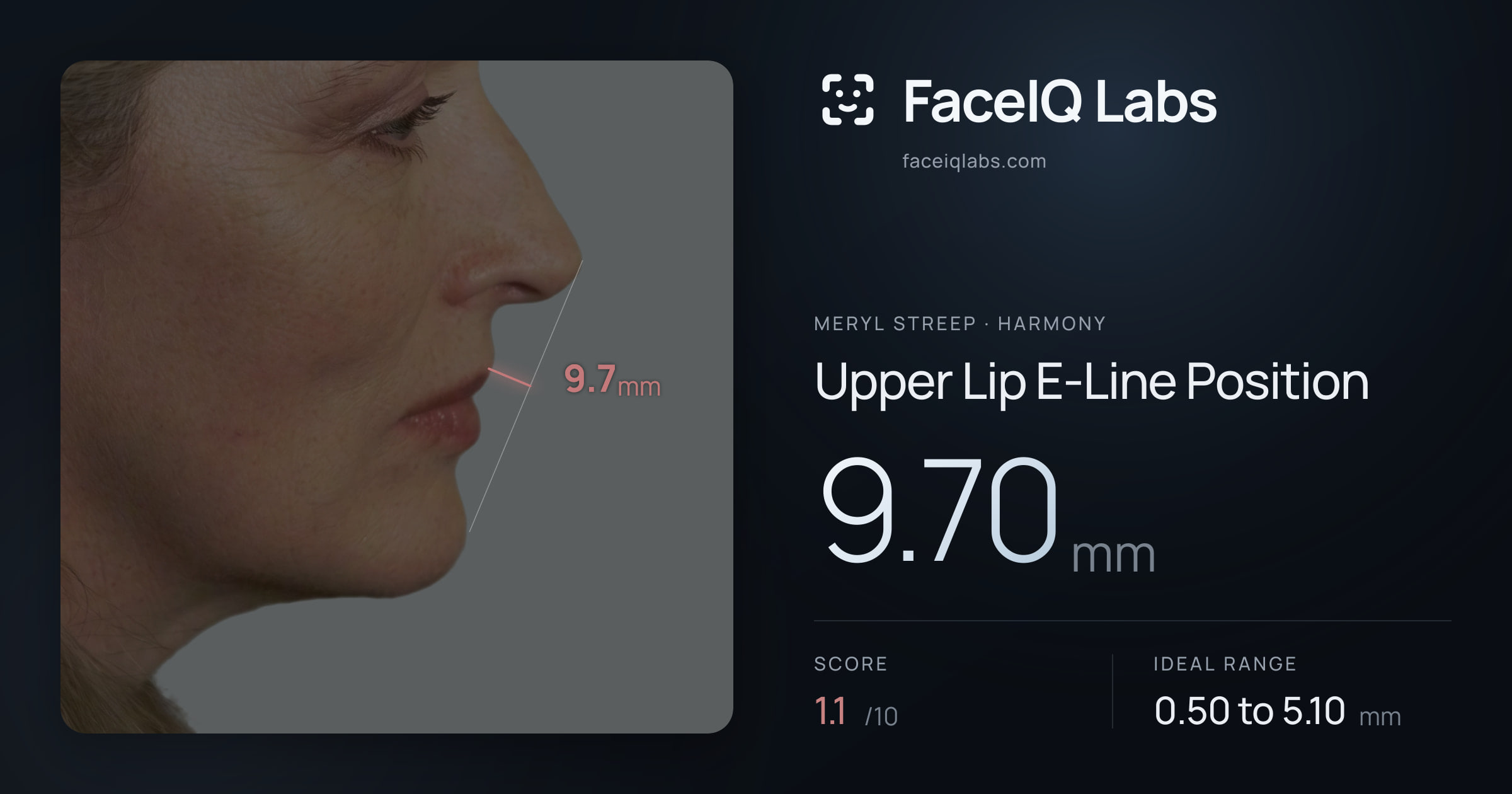 Meryl Streep Upper Lip E-Line Position: 9.70mm, drawn on the photo