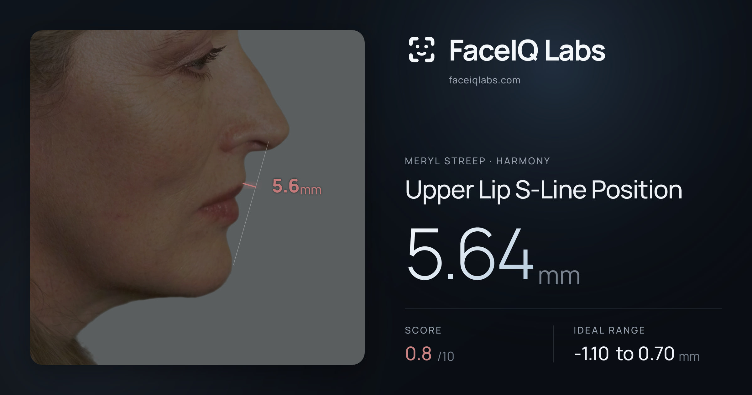 Meryl Streep Upper Lip S-Line Position: 5.64mm, drawn on the photo