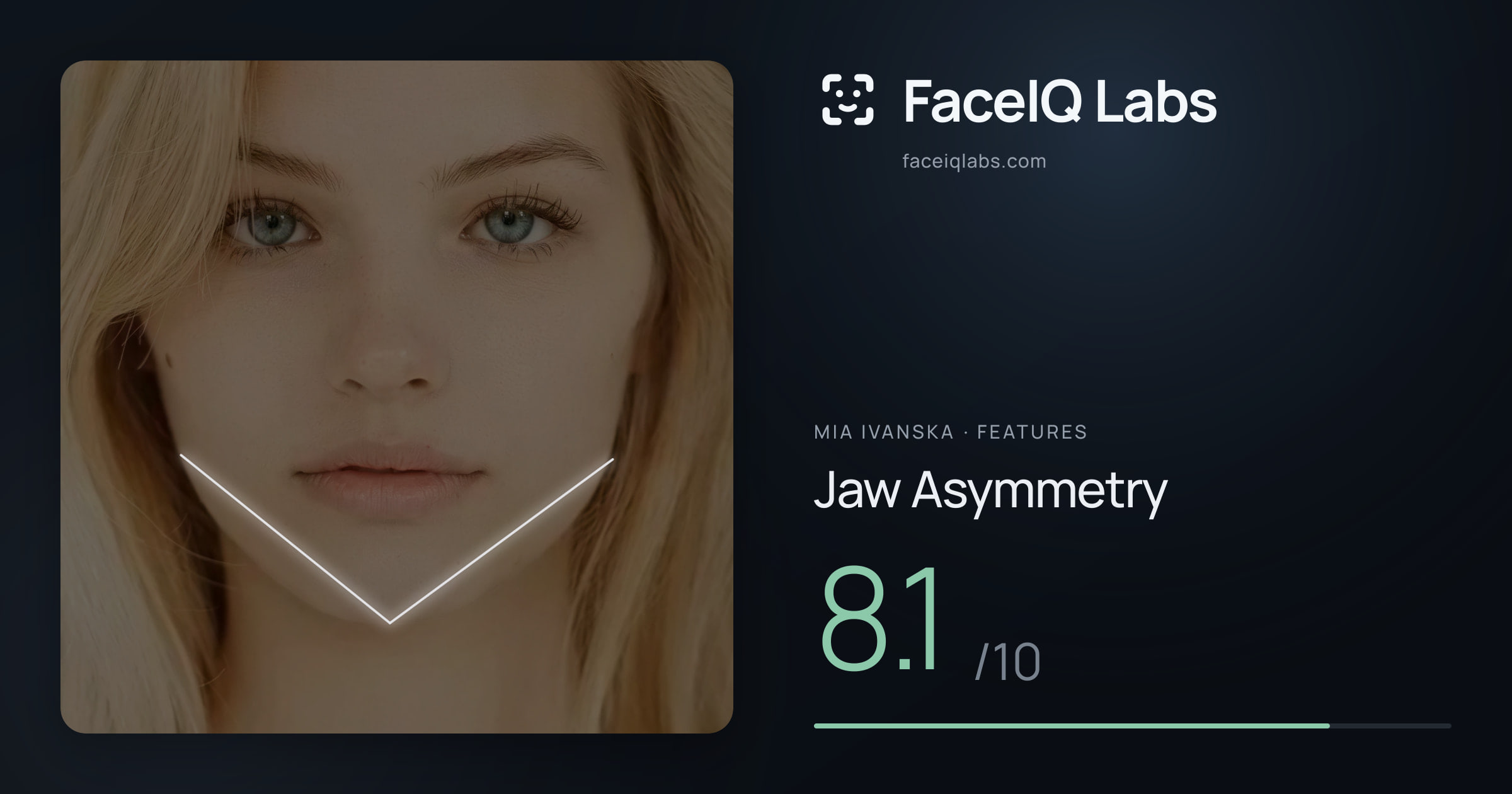 Mia Ivanska Jaw Asymmetry: 8.1/10, drawn on the photo