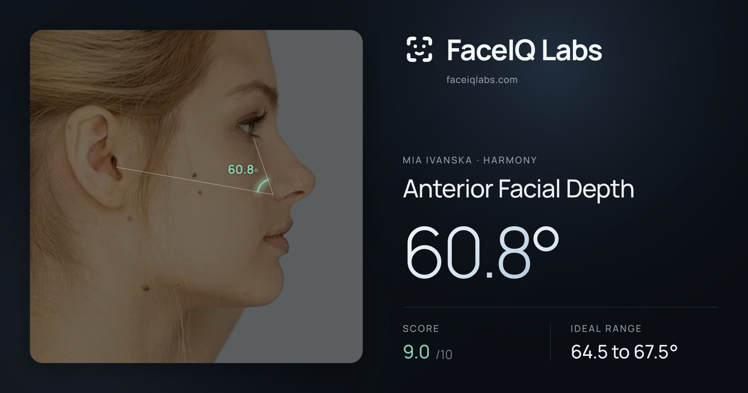 Mia Ivanska Anterior Facial Depth: 60.8°, drawn on the photo