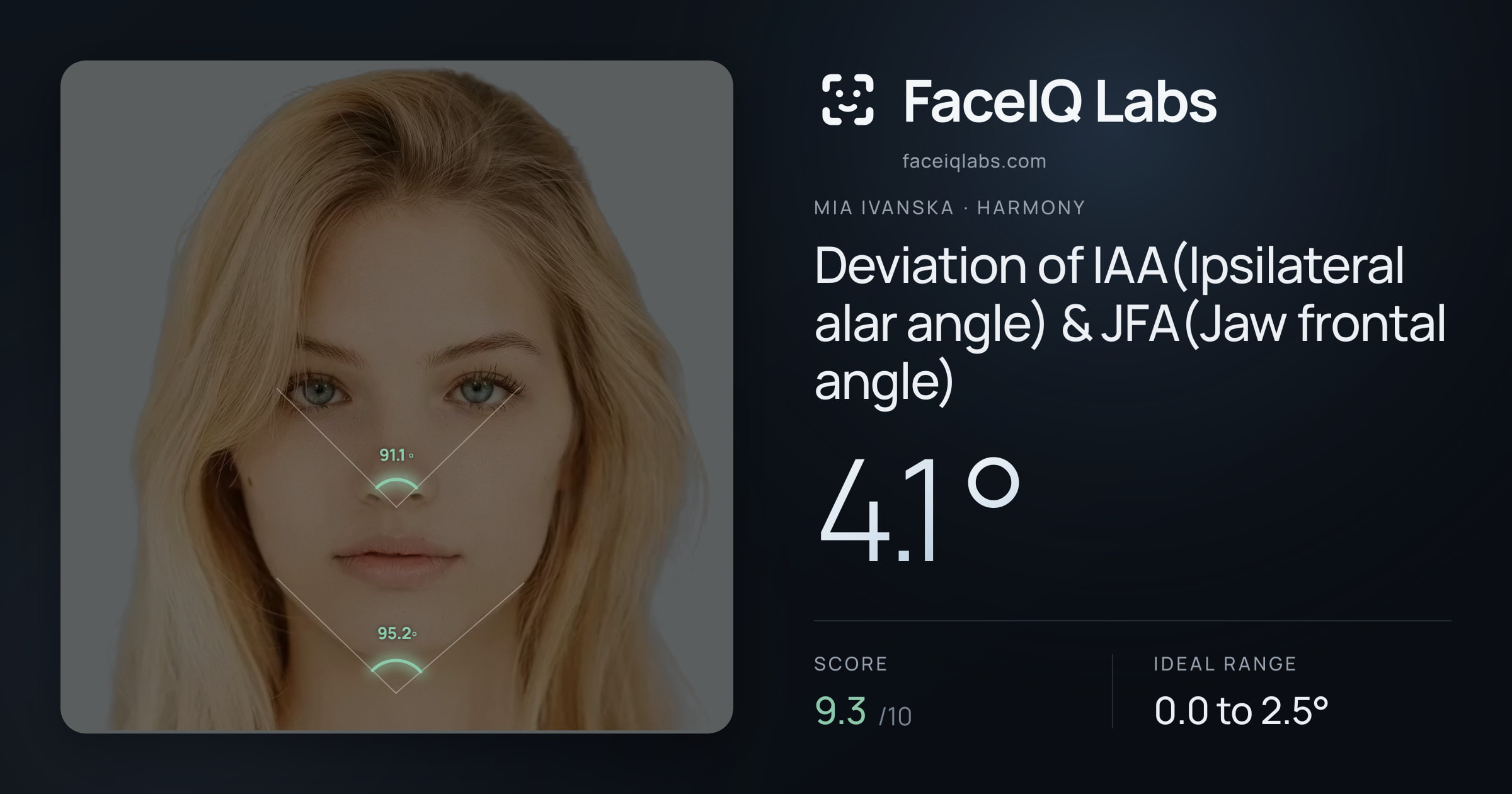 Mia Ivanska Deviation of IAA(Ipsilateral alar angle) & JFA(Jaw frontal angle): 4.1°, drawn on the photo