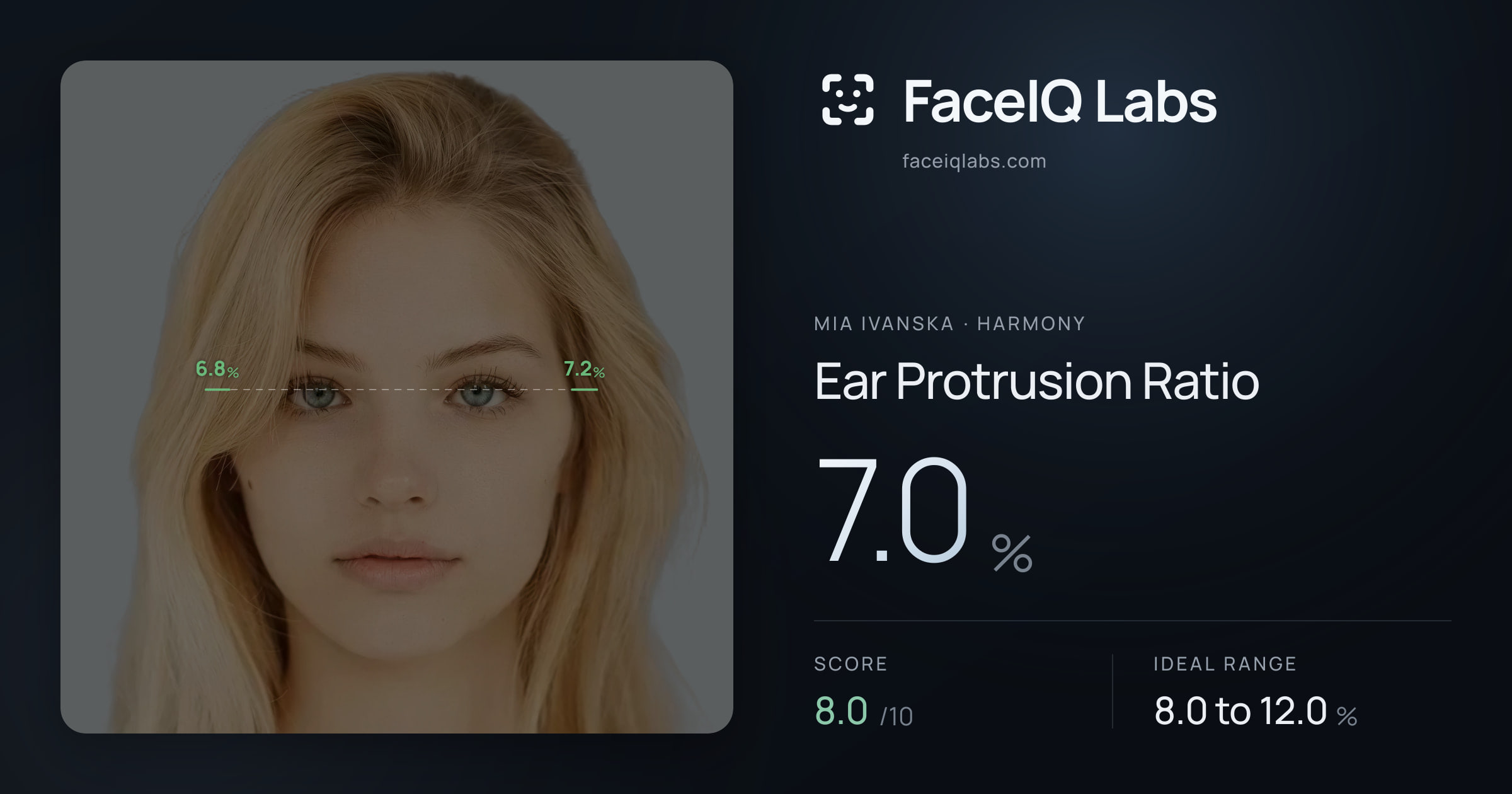 Mia Ivanska Ear Protrusion Ratio: 7.0%, drawn on the photo