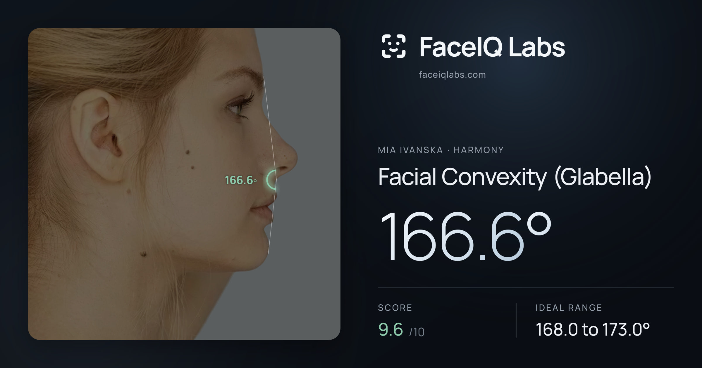 Mia Ivanska Facial Convexity (Glabella): 166.6°, drawn on the photo