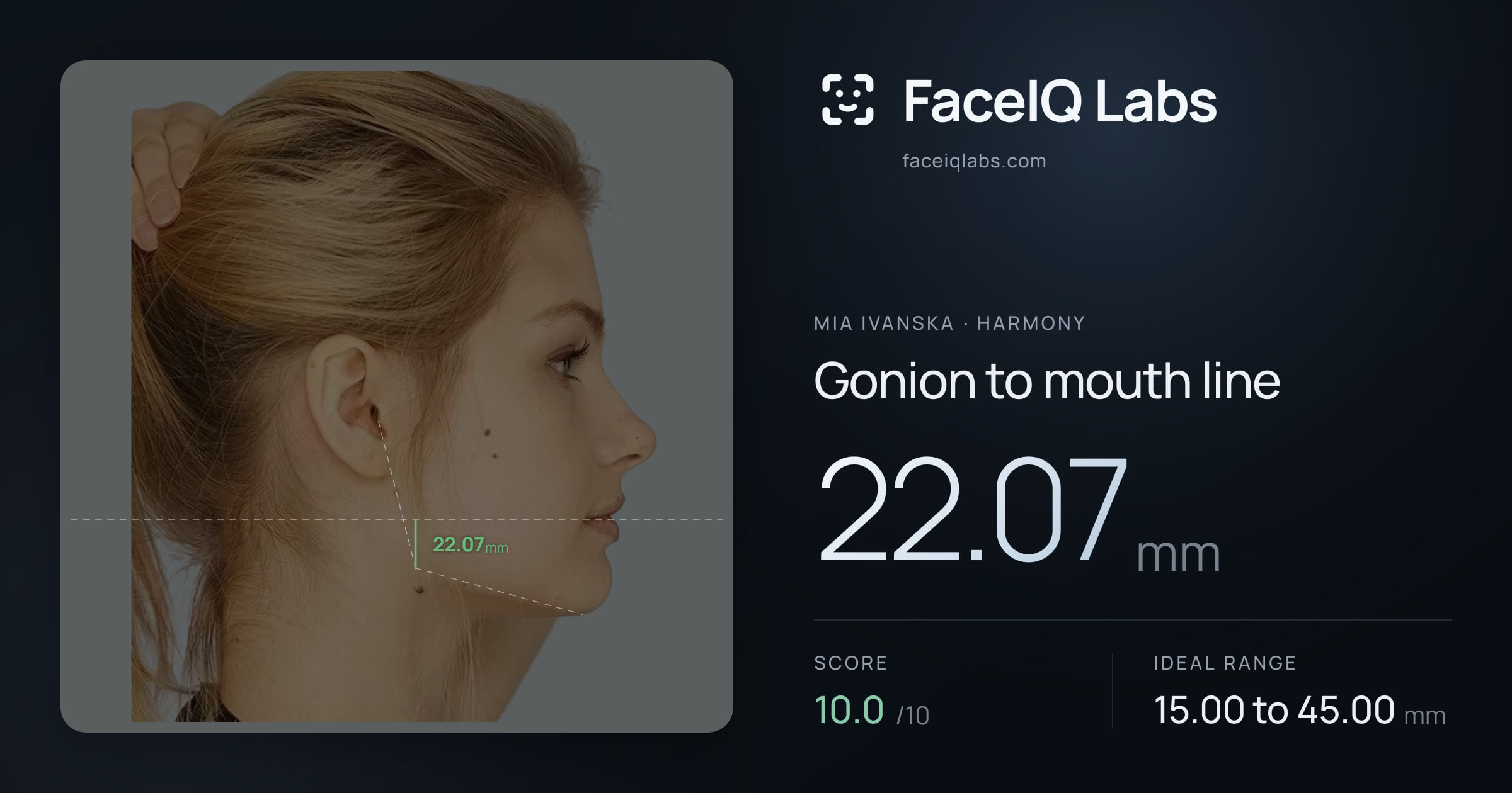 Mia Ivanska Gonion to mouth line: 22.07mm, drawn on the photo