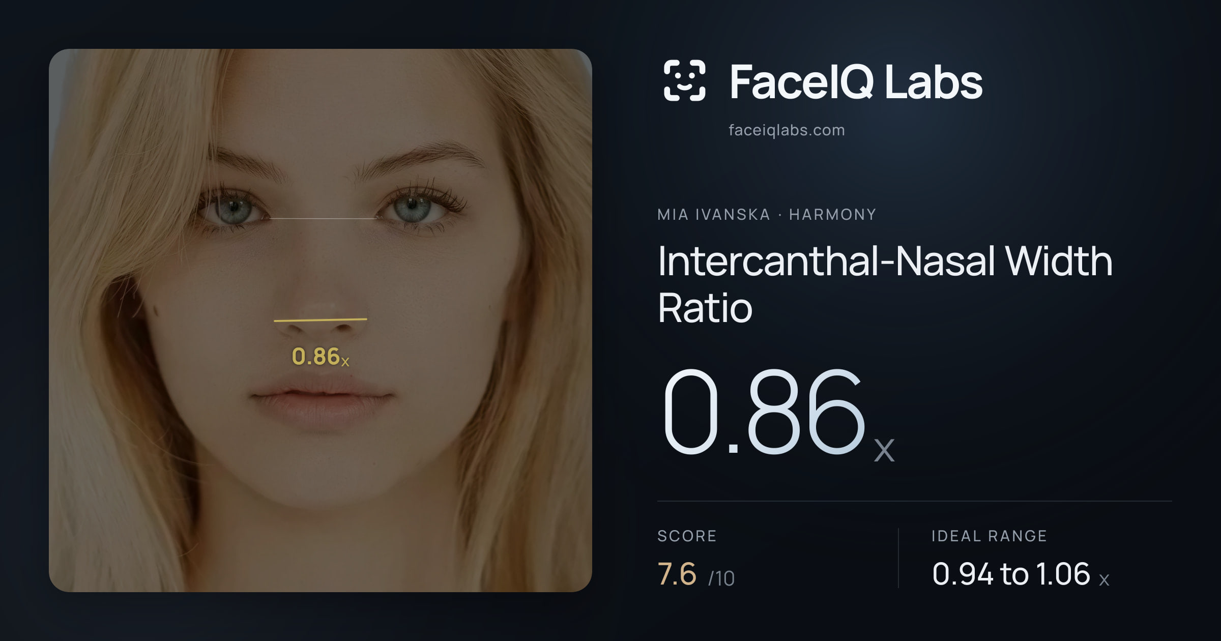 Mia Ivanska Intercanthal-Nasal Width Ratio: 0.86x, drawn on the photo