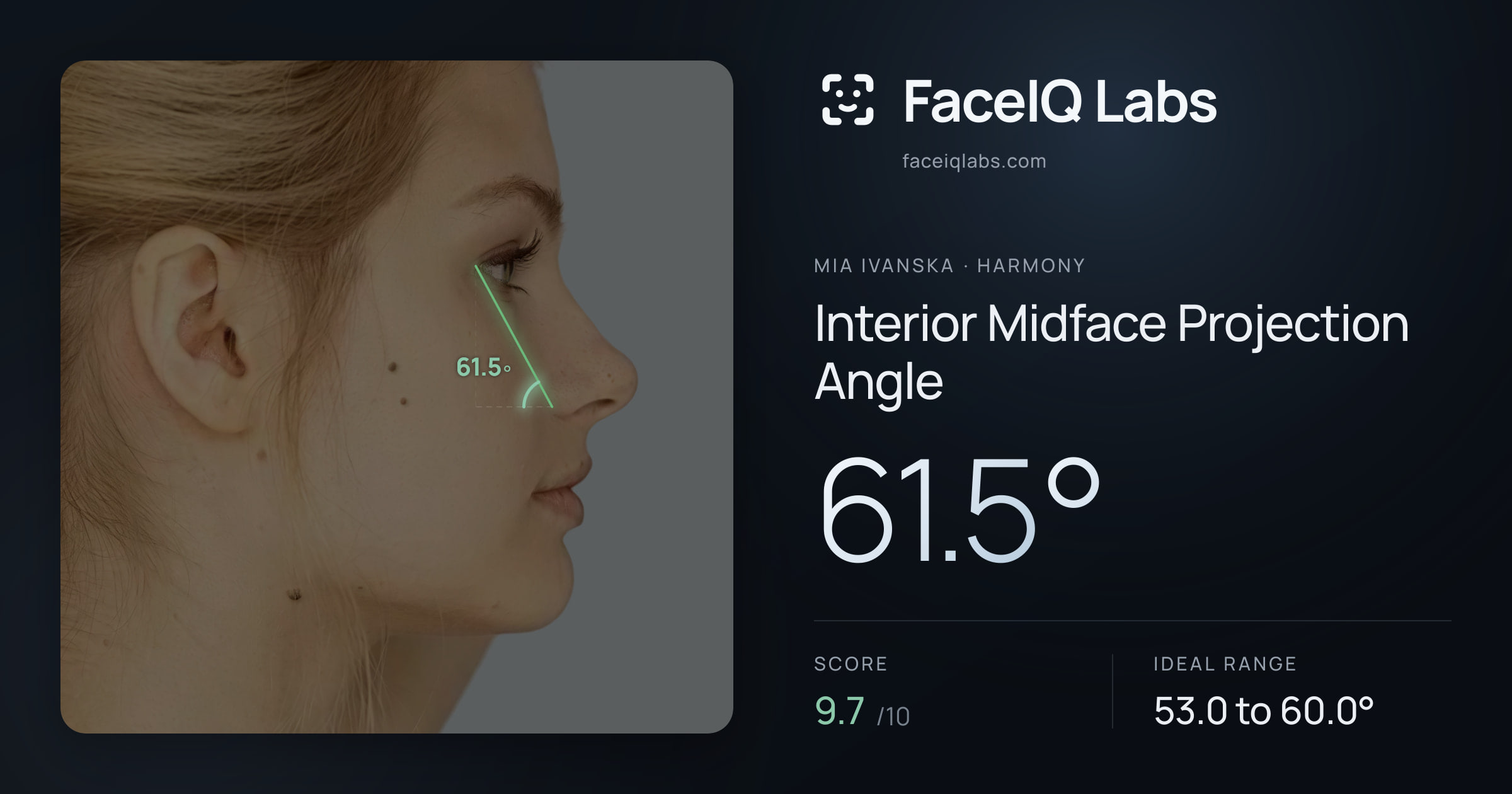 Mia Ivanska Interior Midface Projection Angle: 61.5°, drawn on the photo