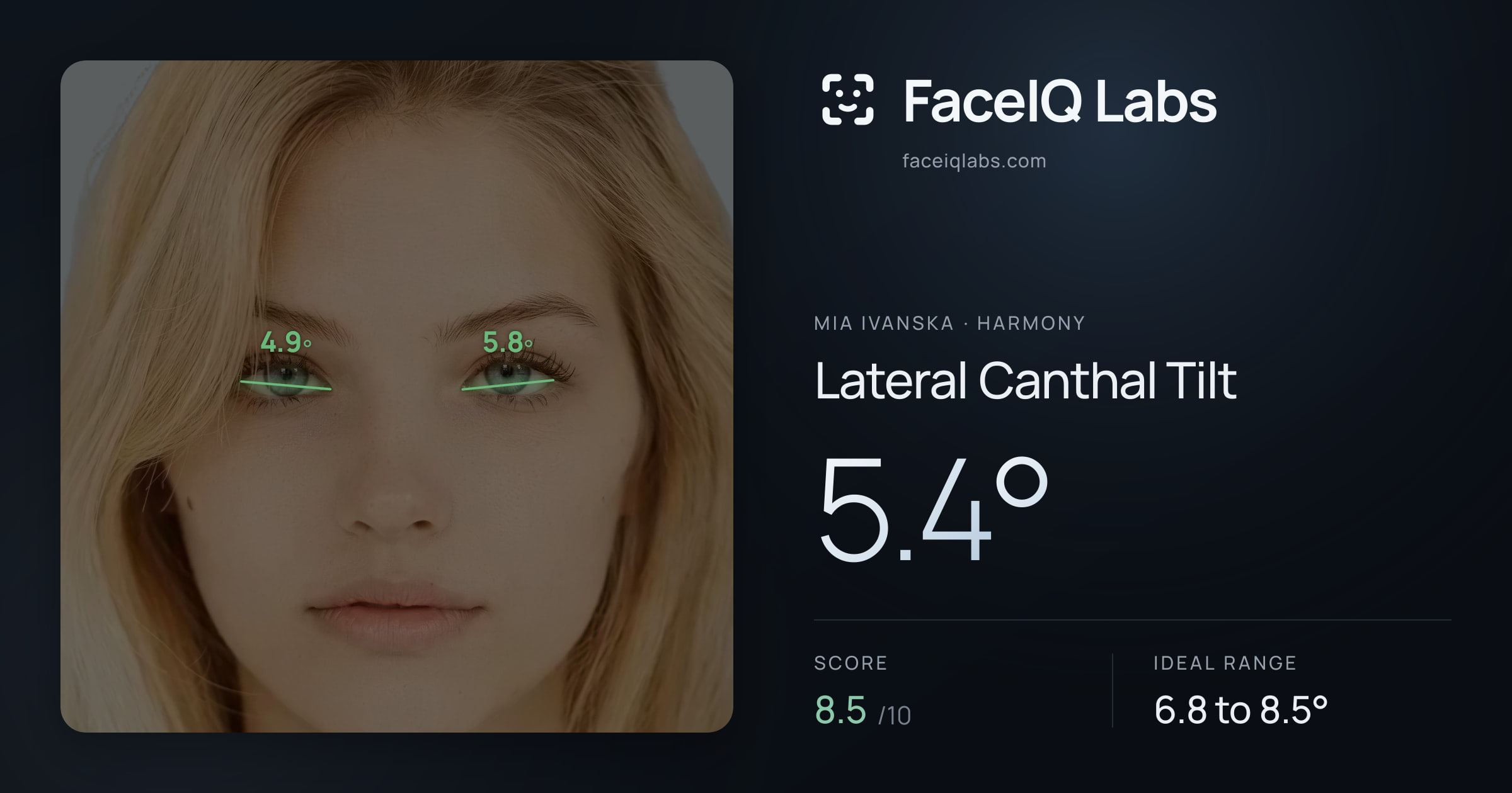 Mia Ivanska Lateral Canthal Tilt: 5.4°, drawn on the photo