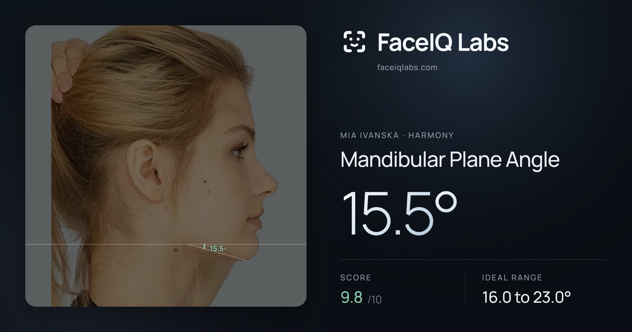 Mia Ivanska Mandibular Plane Angle: 15.5°, drawn on the photo